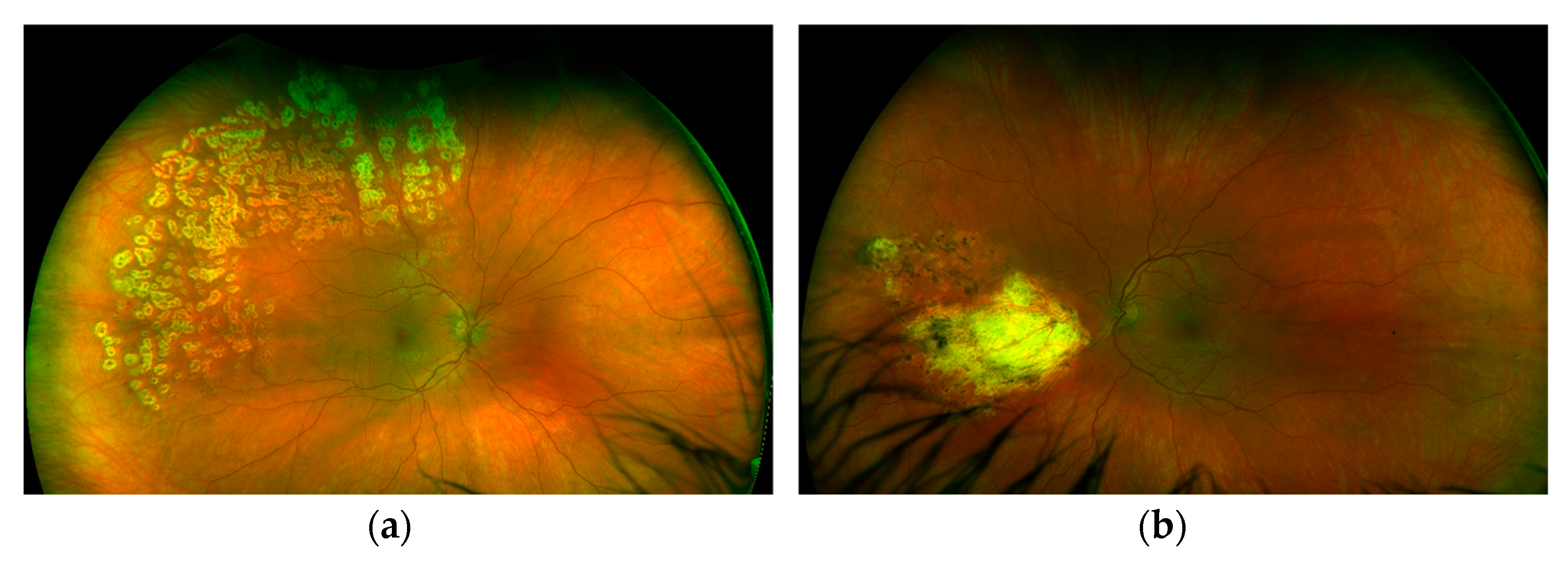 Ijms 24 02594 g004 Ijms 24 02594 g004