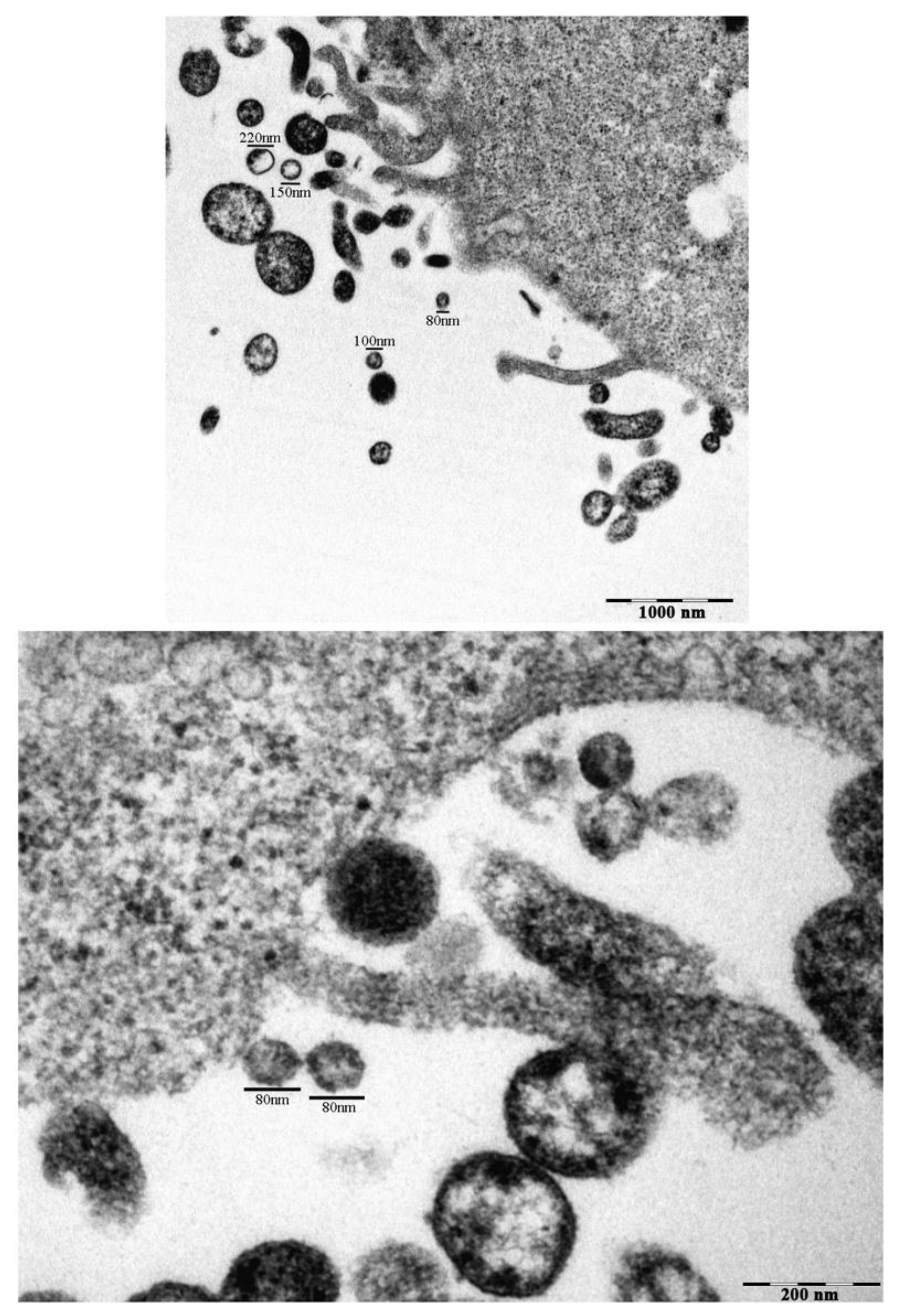 IJMS | Free Full-Text | Extra-Cellular Vesicles Derived From Thyroid ...