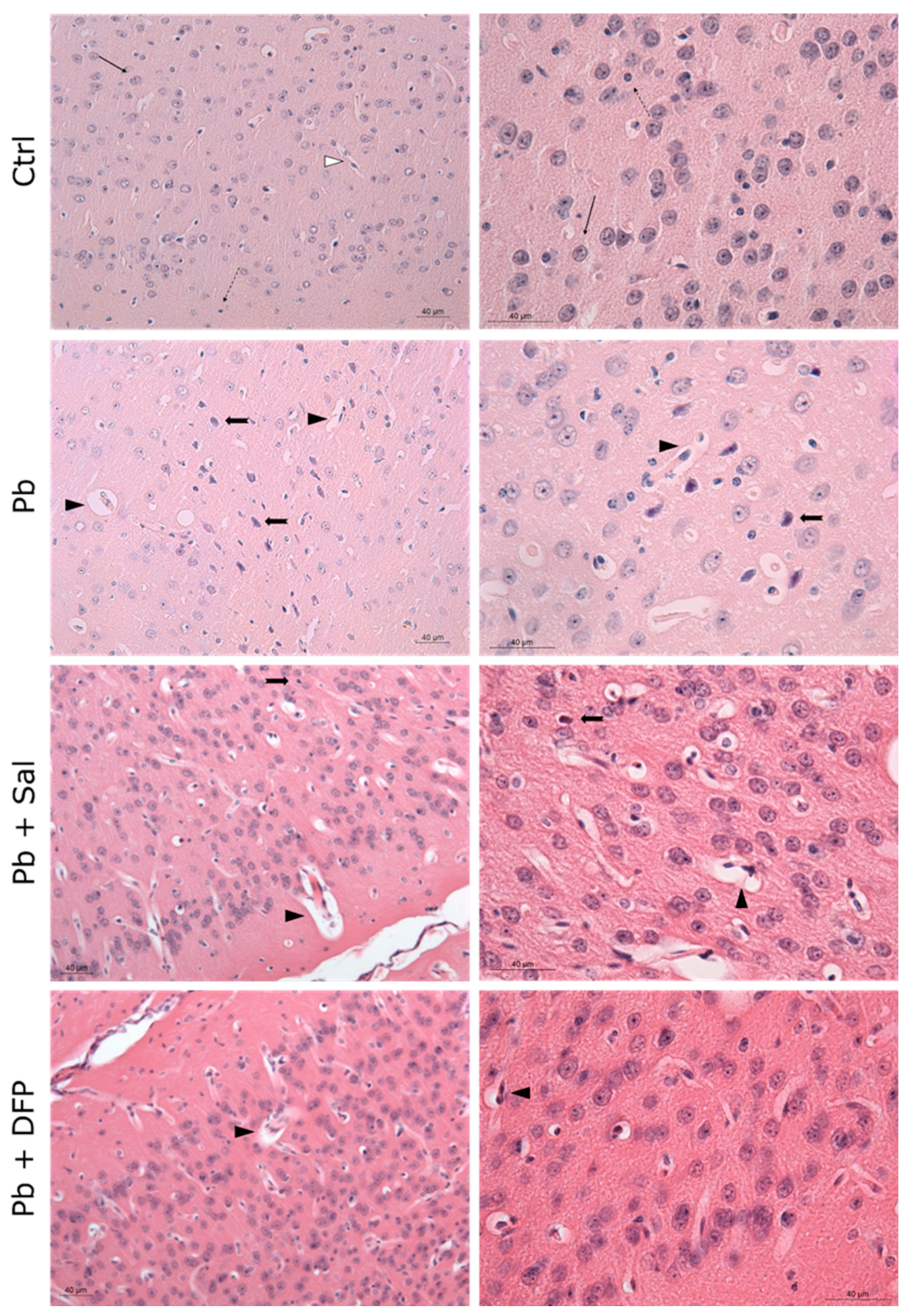 Ijms 24 02871 g003 Ijms 24 02871 g003