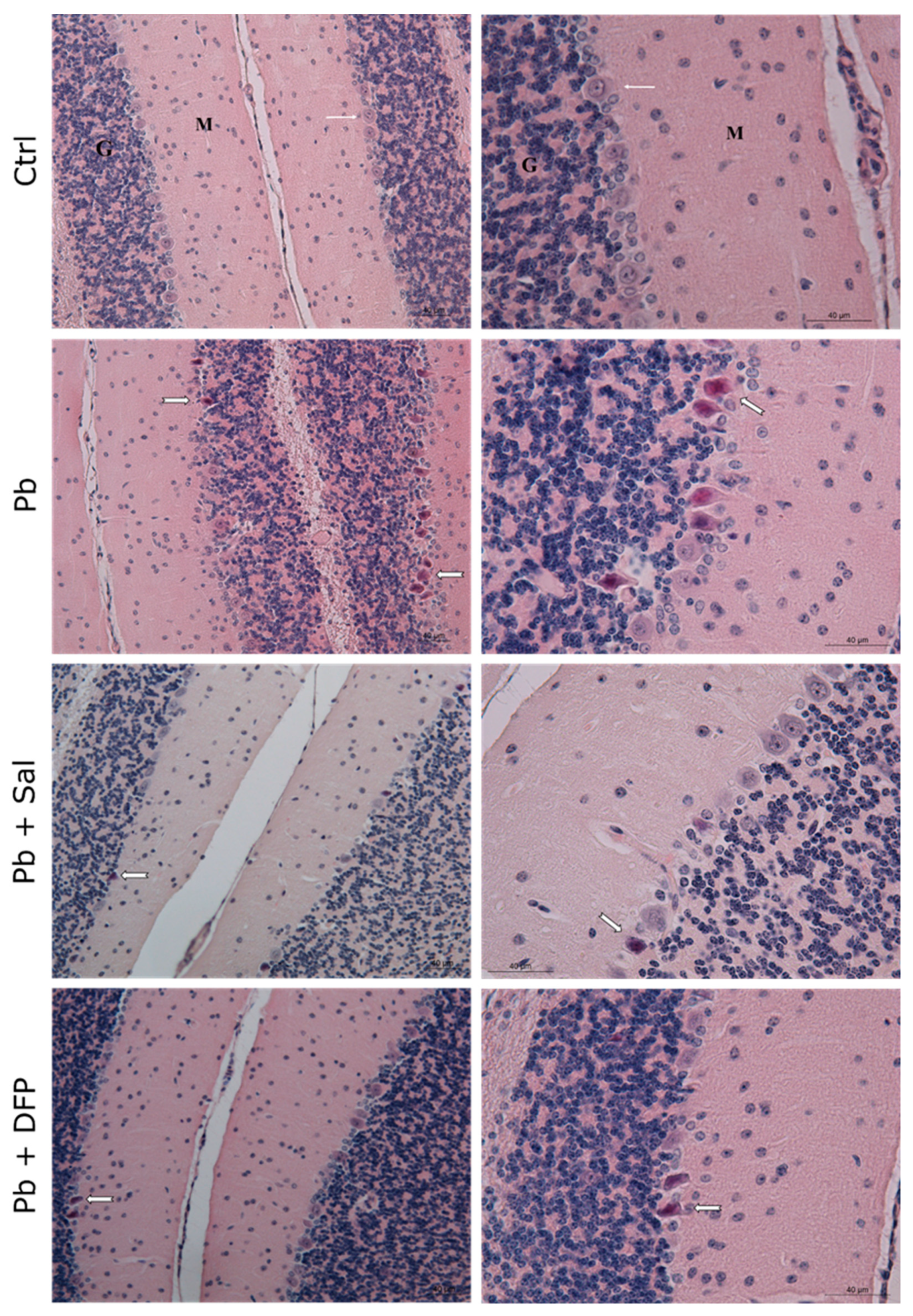 Ijms 24 02871 g004 Ijms 24 02871 g004