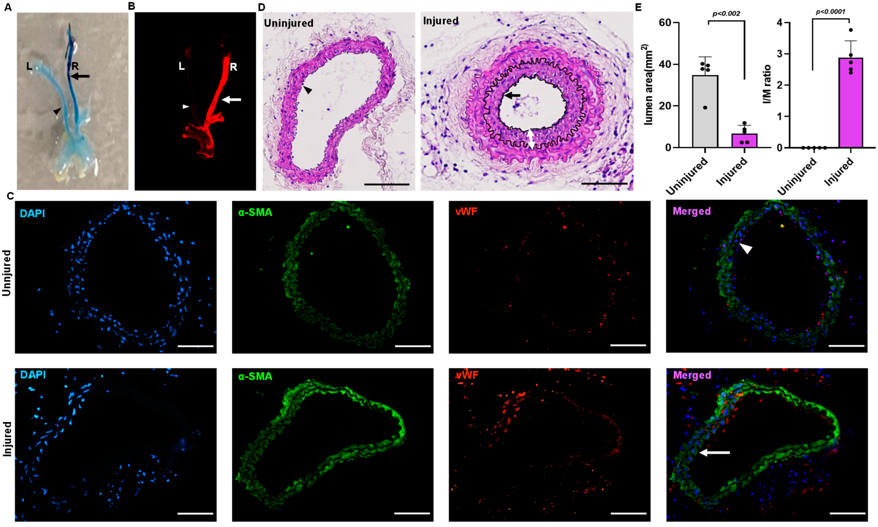 IJMS | Free Full-Text | The Autotaxin-LPA Axis Emerges as a Novel