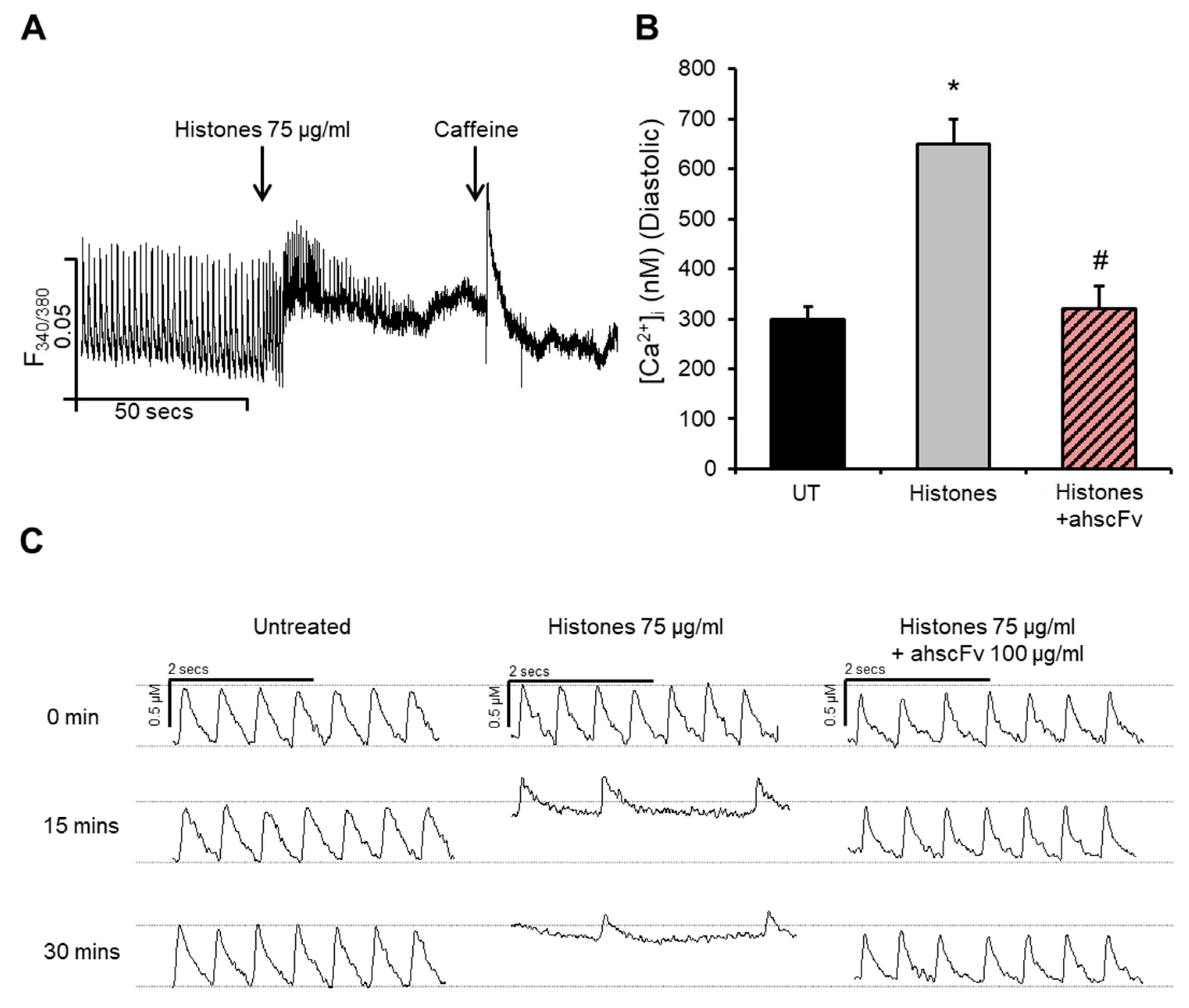 IJMS | Free Full-Text | Extracellular Histone-Induced Protein