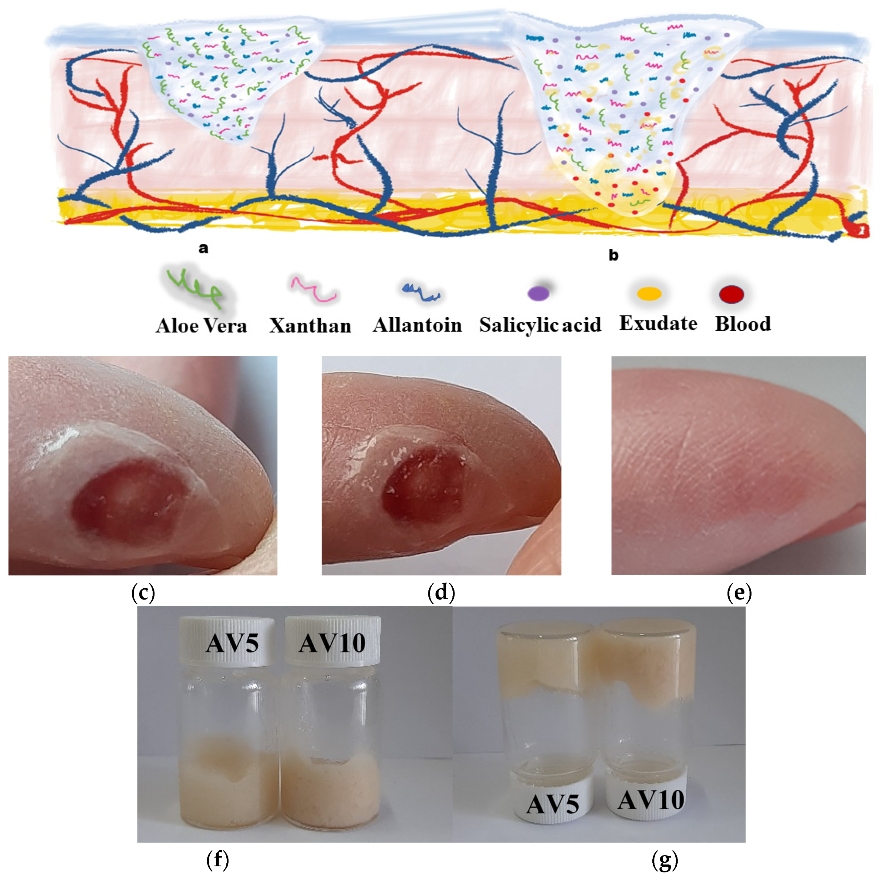 IJMS | Free Full-Text | Antibacterial Aloe vera Based Biocompatible  Hydrogel for Use in Dermatological Applications