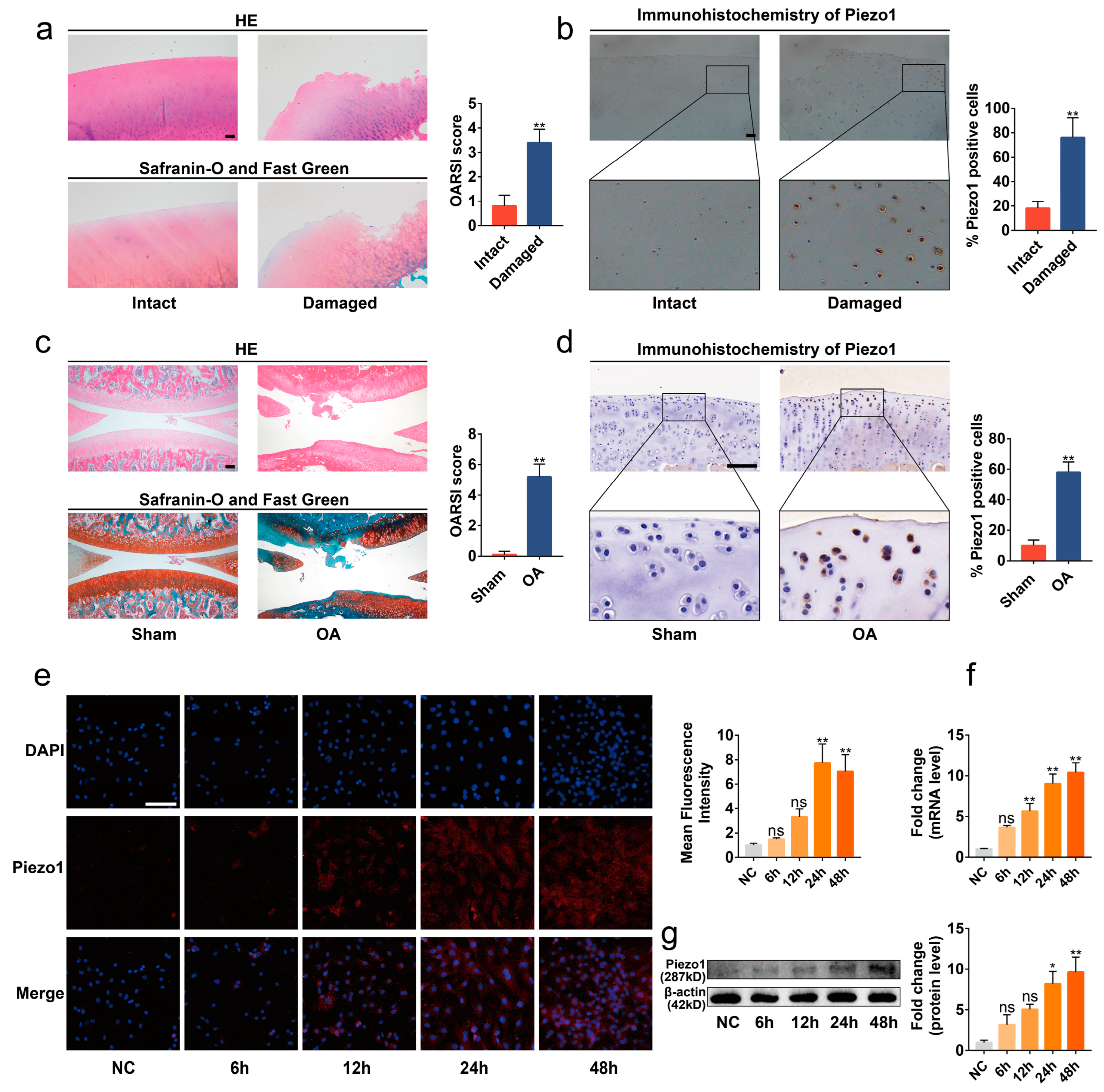 PDF) Excessive mechanical loading promotes osteoarthritis through