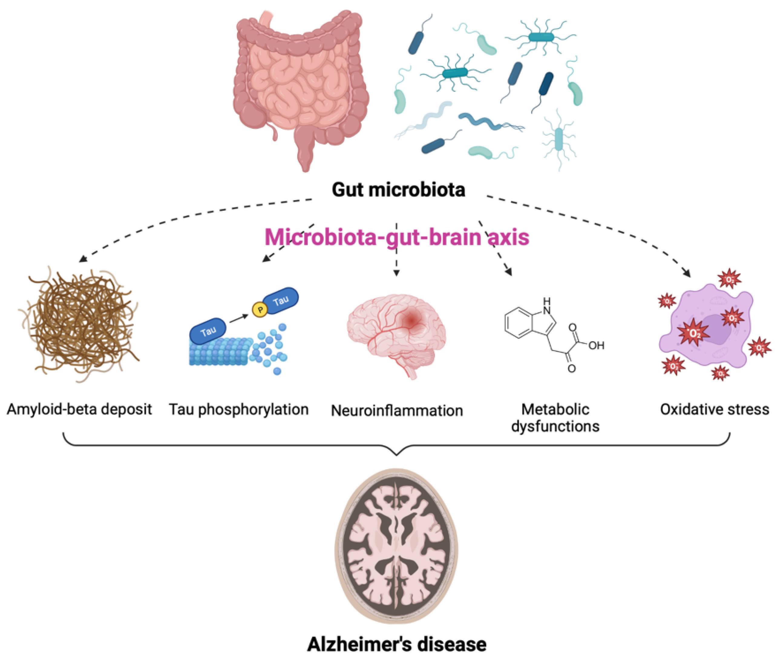 IJMS | Free Full-Text | Gut Microbiota and Alzheimer&rsquo;s Disease: How  to Study and Apply Their Relationship