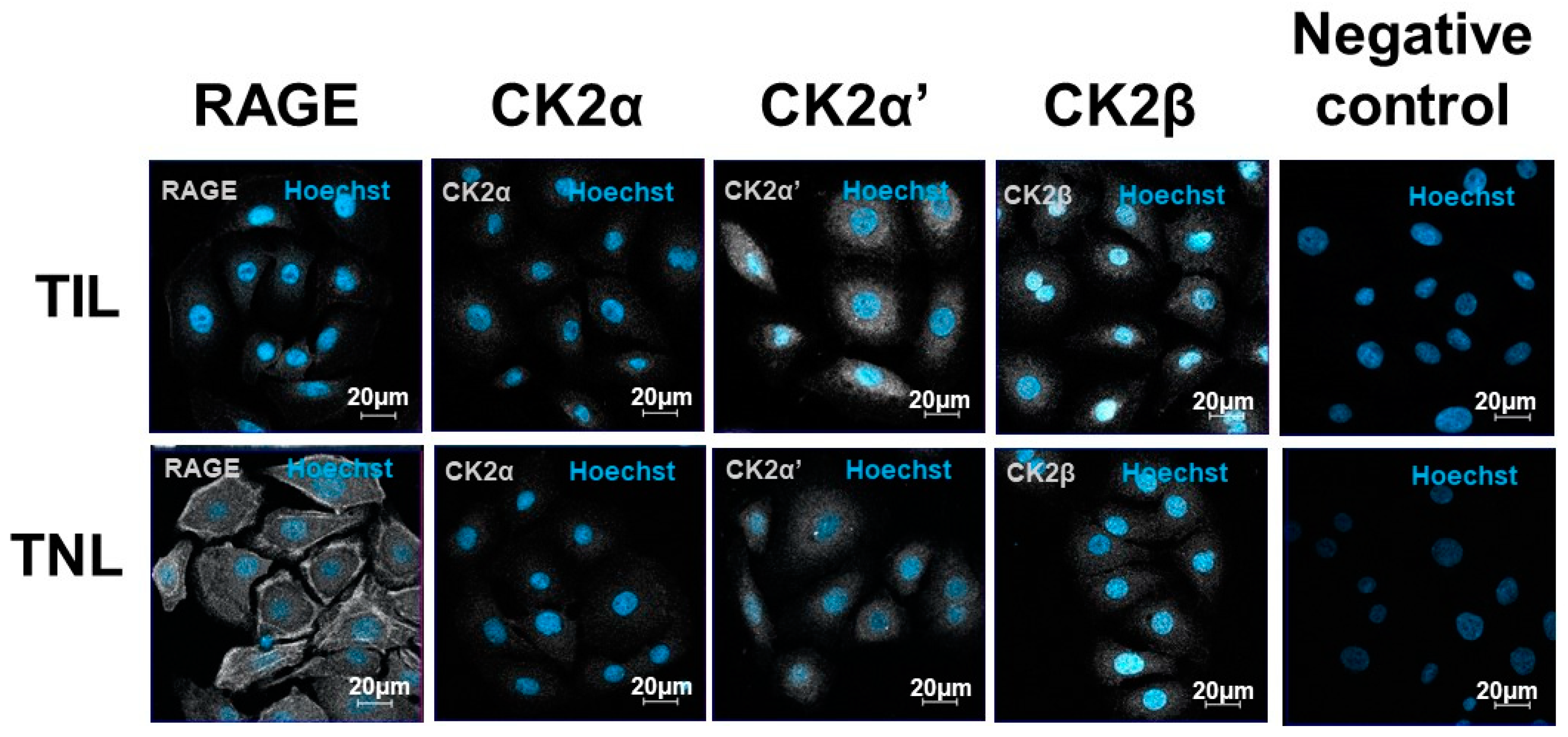 Ijms Free Full Text Characterization Of Rage And Ck2 Expressions In Human Fetal Membranes 