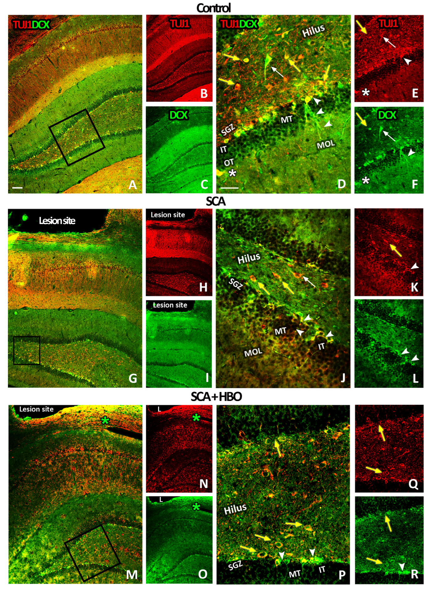 Ijms 24 04261 g005 Ijms 24 04261 g005