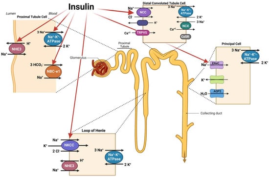 IJMS | Free Full-Text | Pathogenesis of Hypertension in Metabolic ...