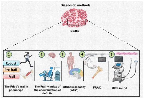 Regular Physical Activity Combats Frailty