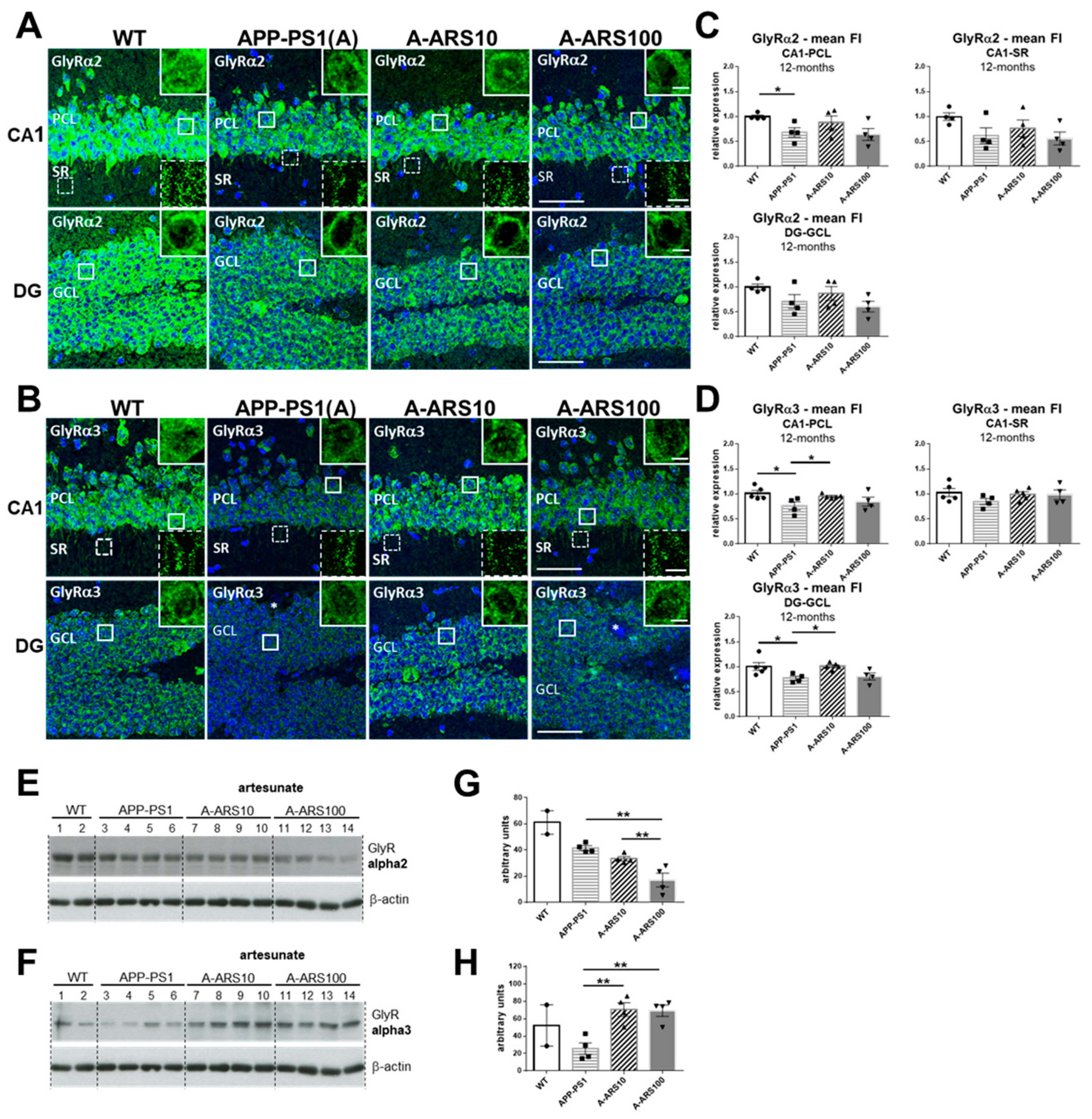 Ijms 24 04623 g004 Ijms 24 04623 g004