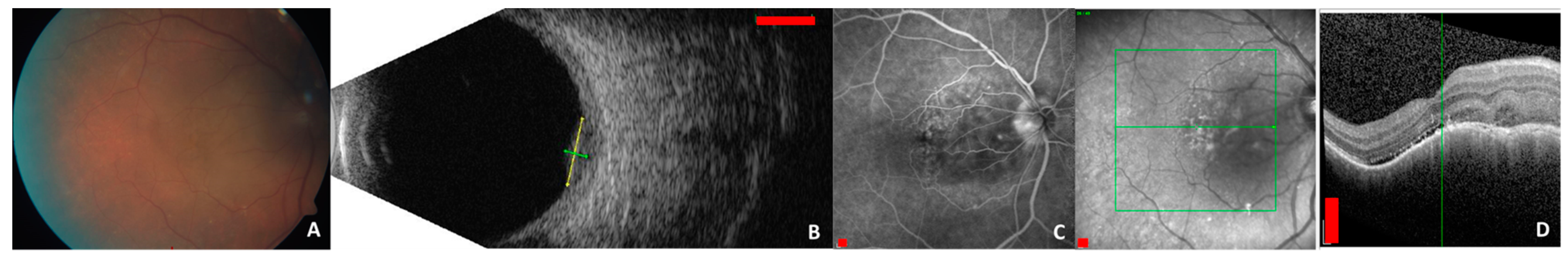 Ijms 24 04698 g002 Ijms 24 04698 g002