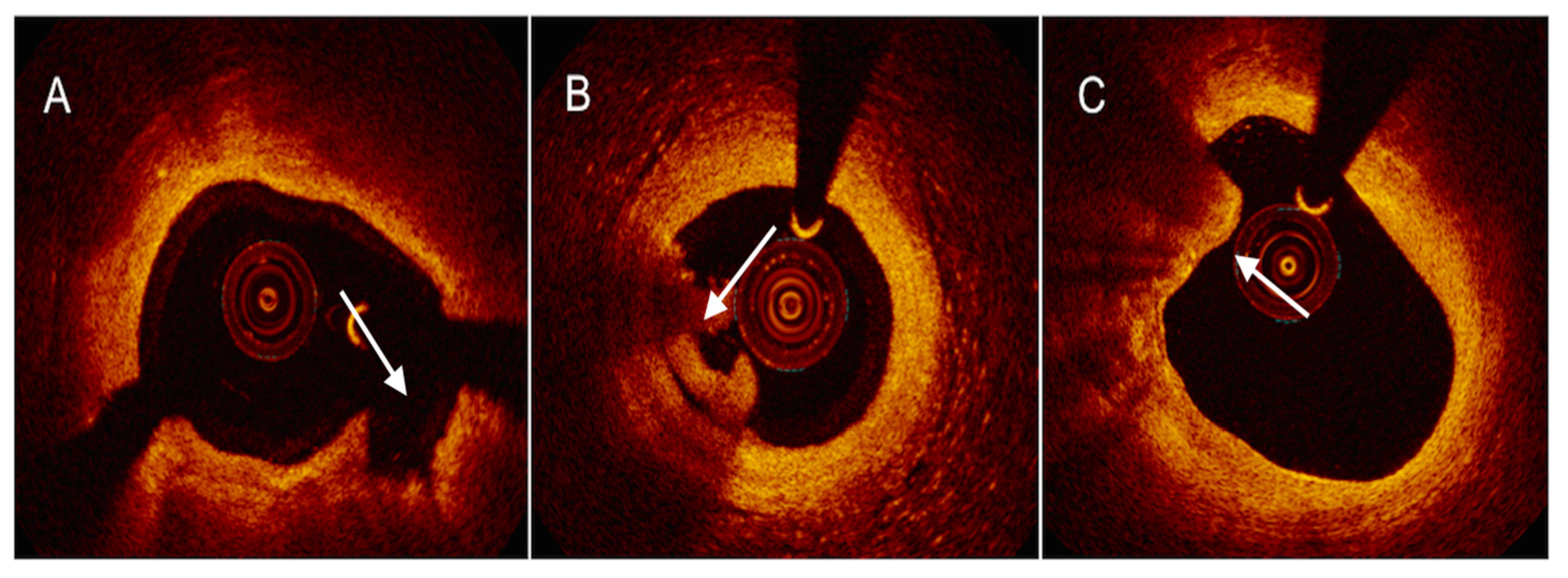 Ijms 24 05155 g004 Ijms 24 05155 g004