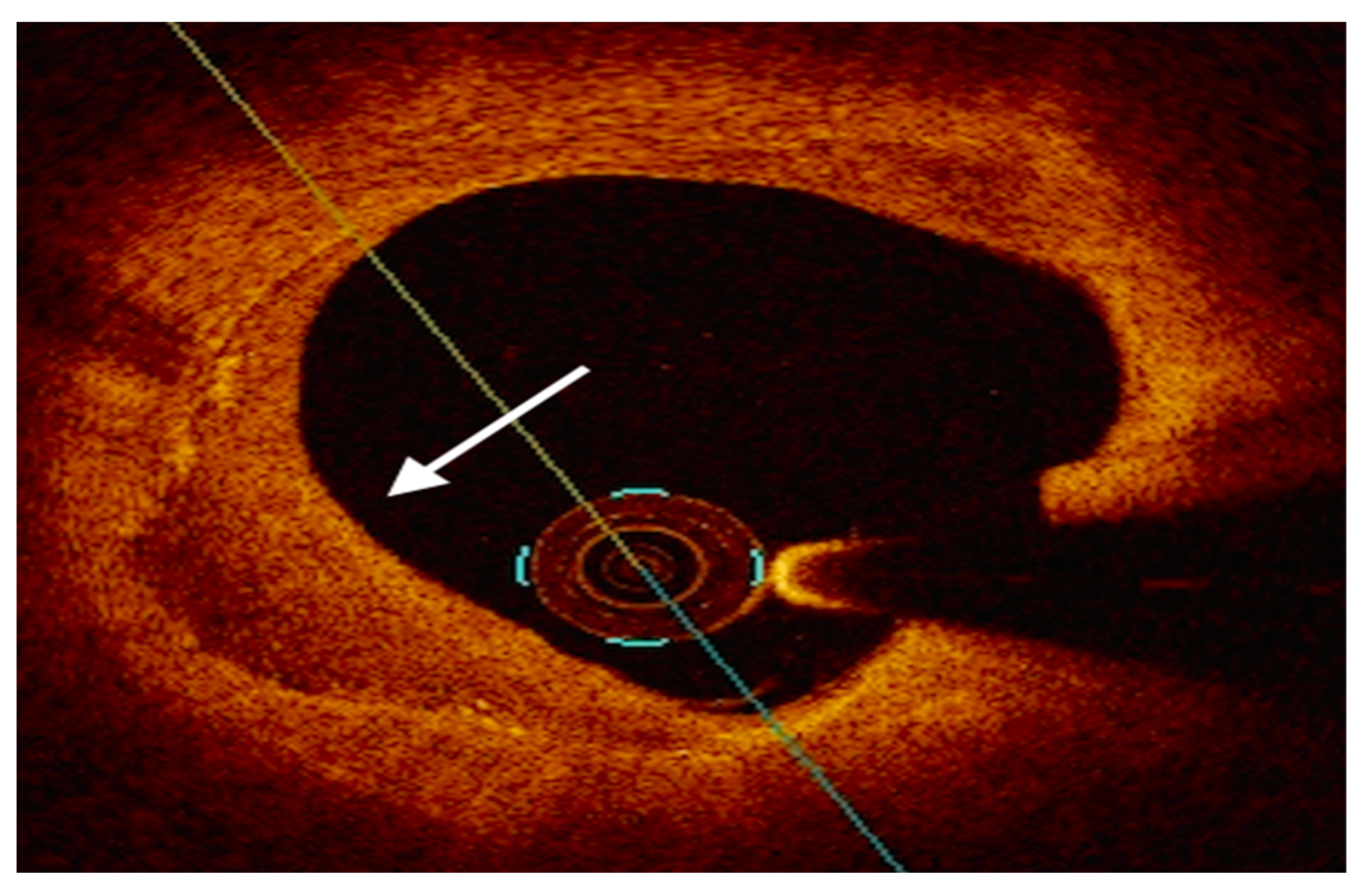 Ijms 24 05155 g005 Ijms 24 05155 g005
