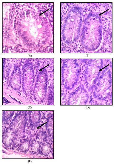 IJMS | Free Full-Text | The Potential Chemopreventive Effect of ...