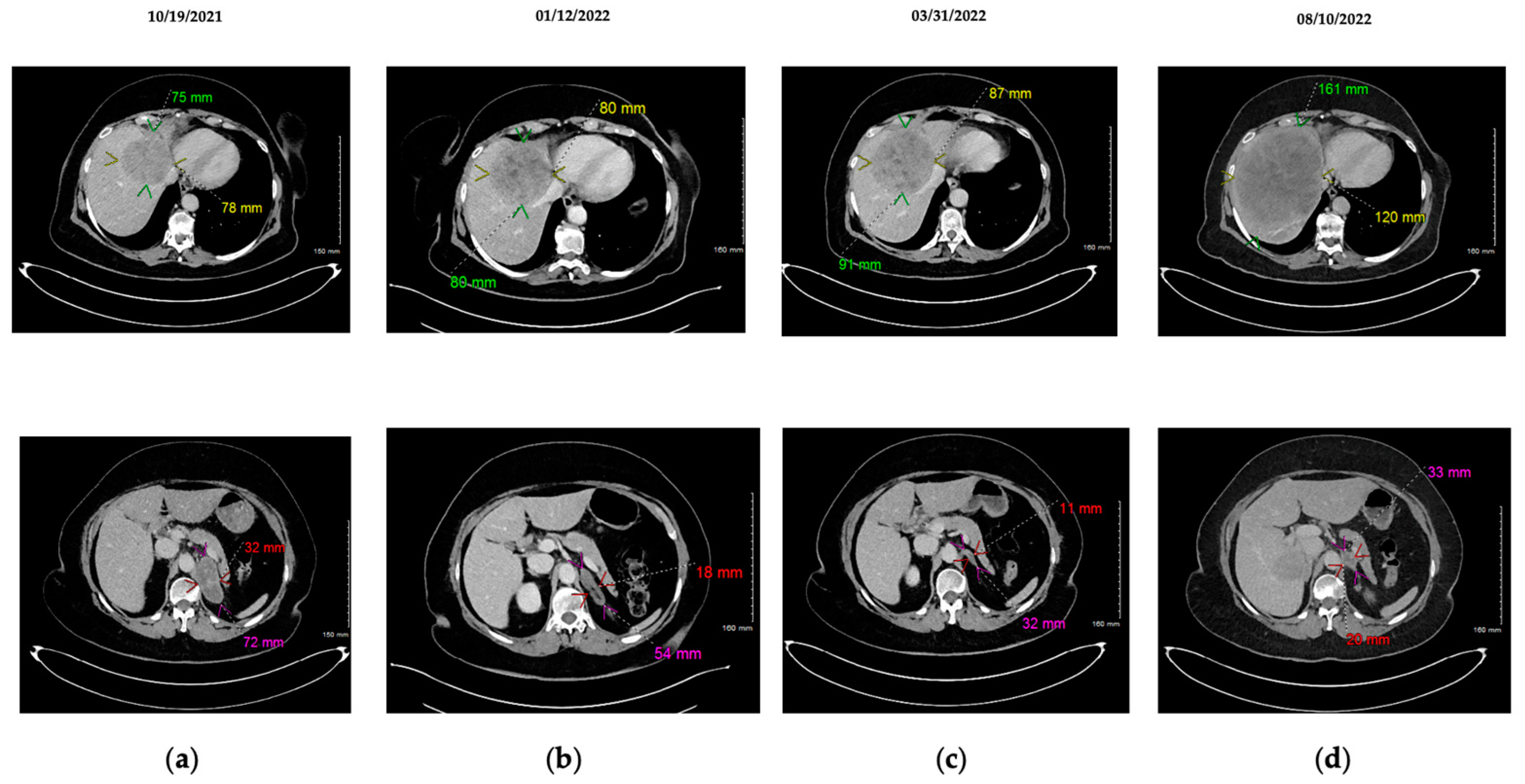 Ijms 24 05518 g002 Ijms 24 05518 g002