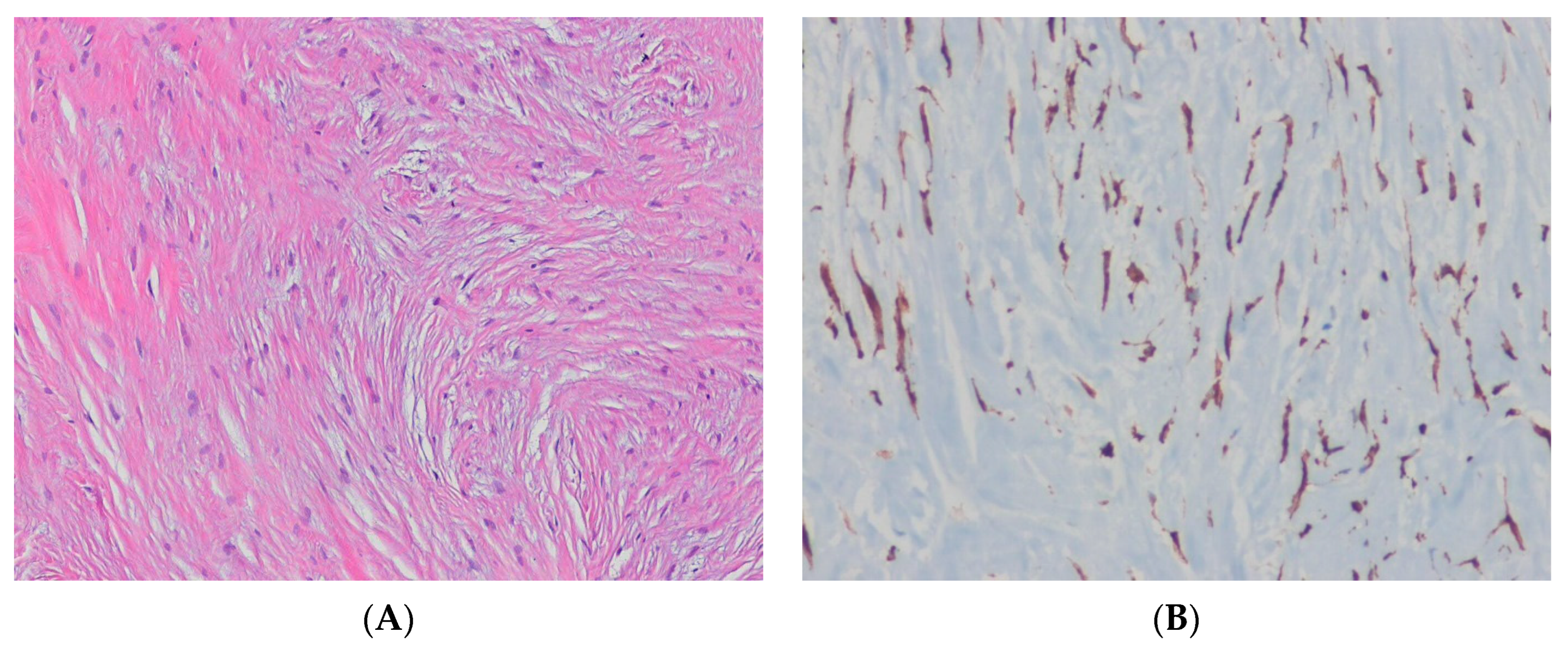 Ijms 24 05934 g004 Ijms 24 05934 g004