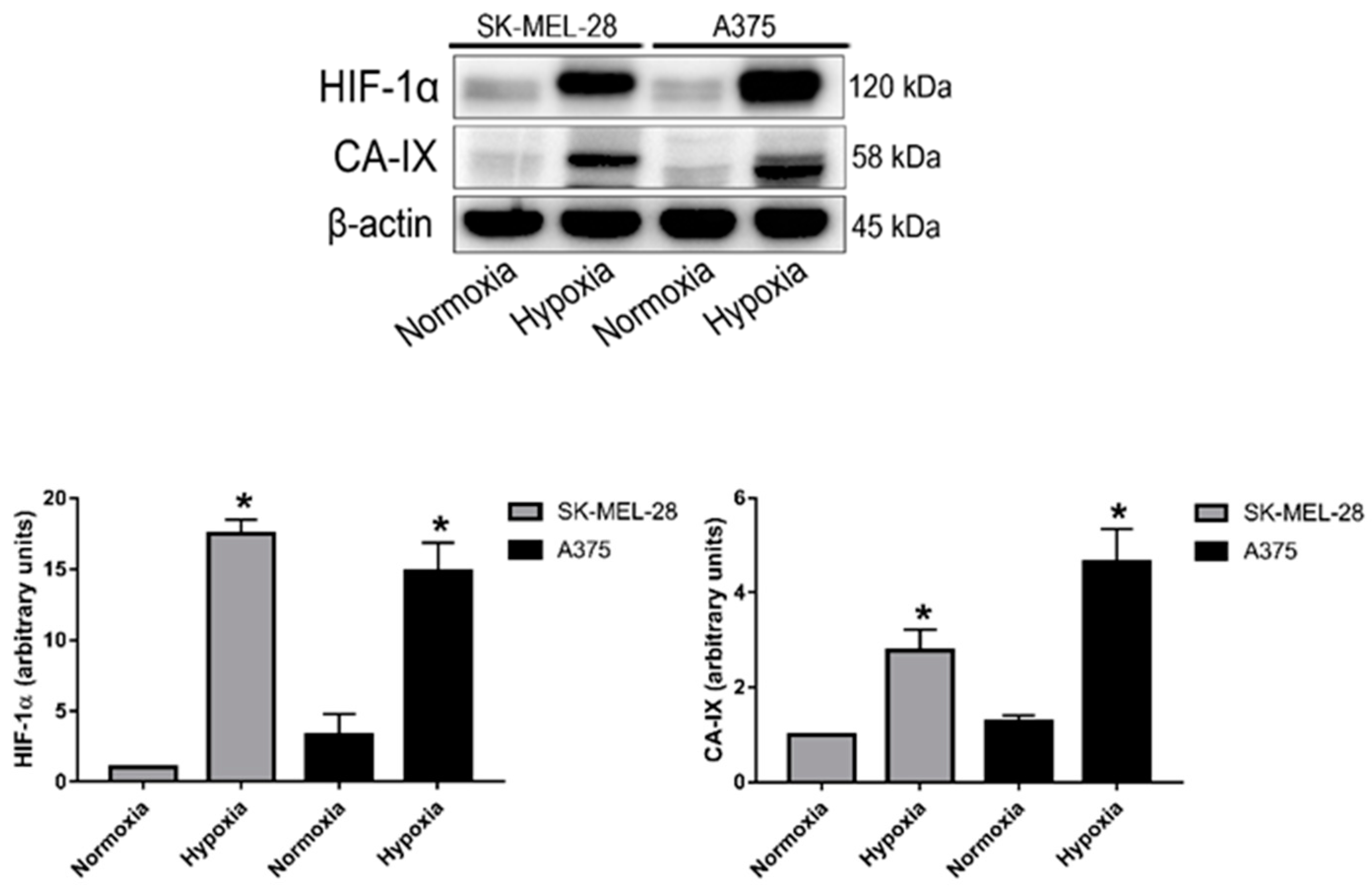 IJMS | Free Full-Text | CA-IX-Expressing Small Extracellular Vesicles  (sEVs) Are Released by Melanoma Cells under Hypoxia and in the Blood of  Advanced Melanoma Patients