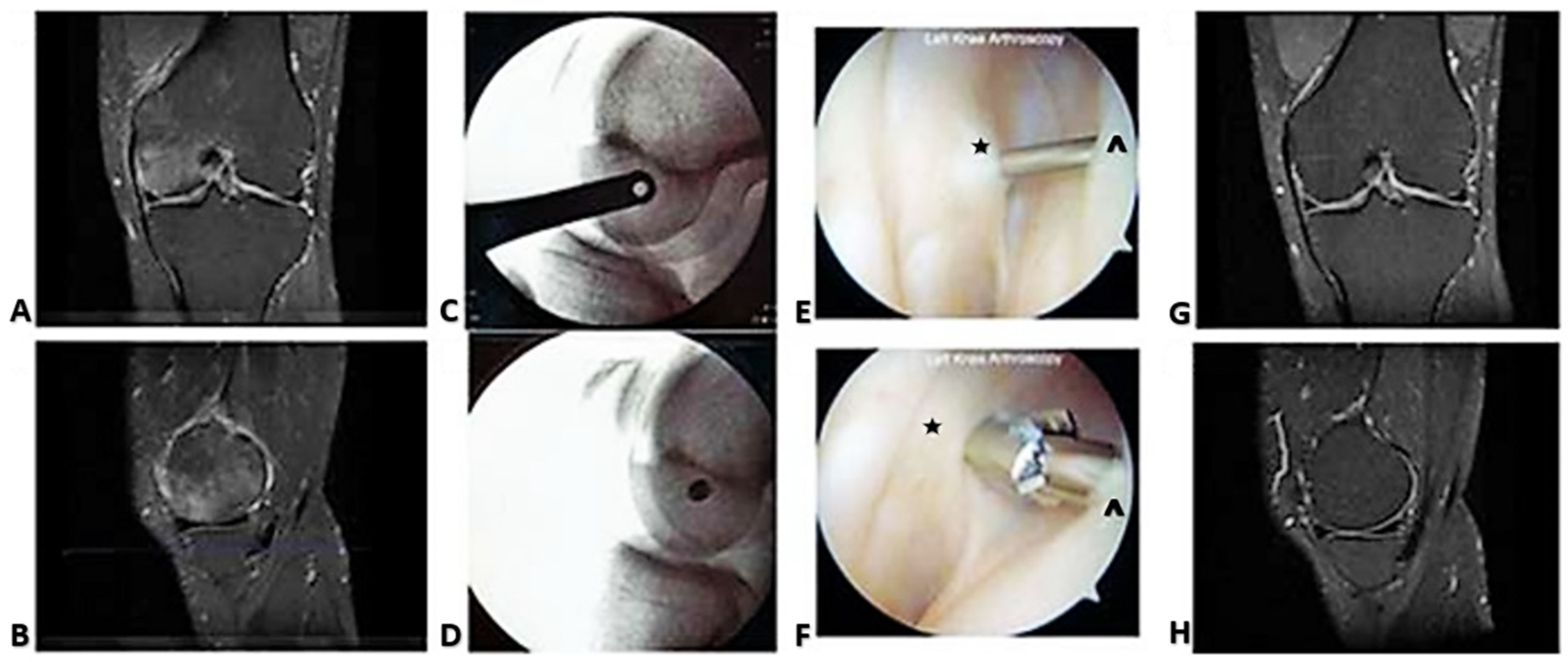 Pin on health/edema