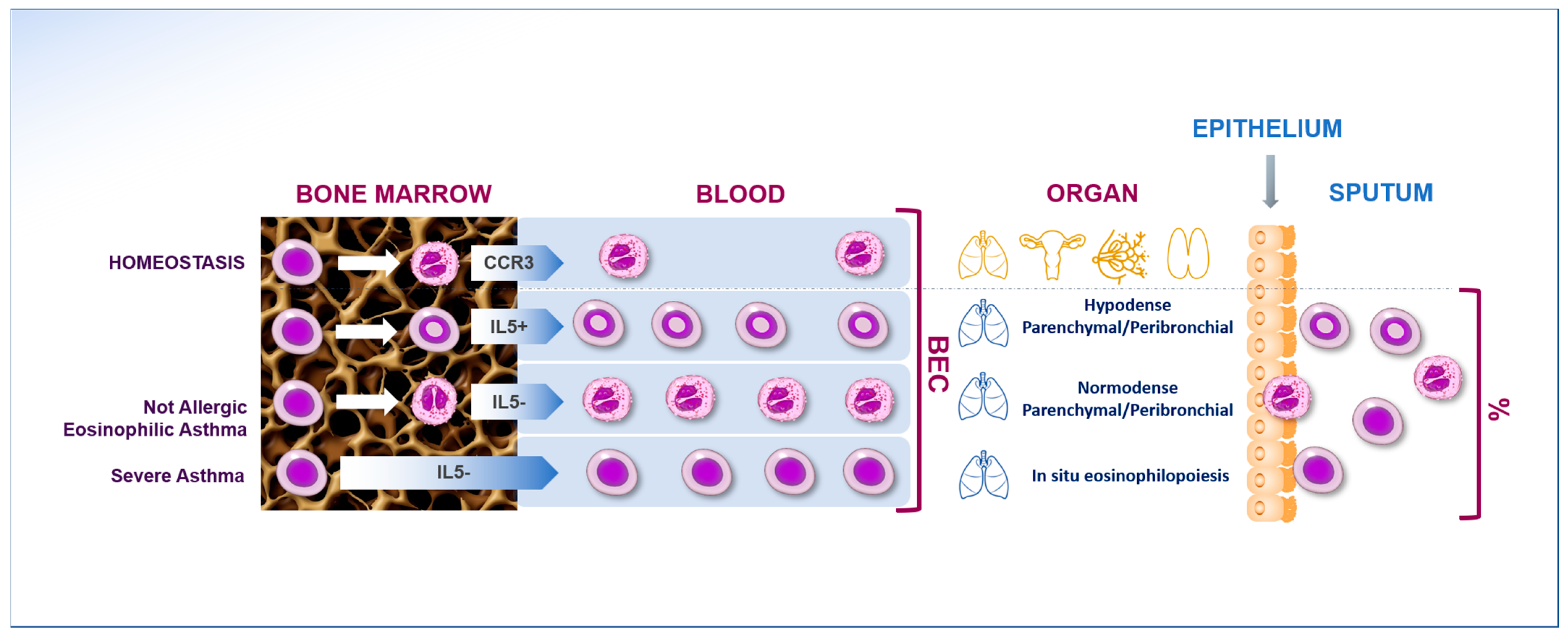 IJMS Free Full Text Eosinophilic Airway Diseases From