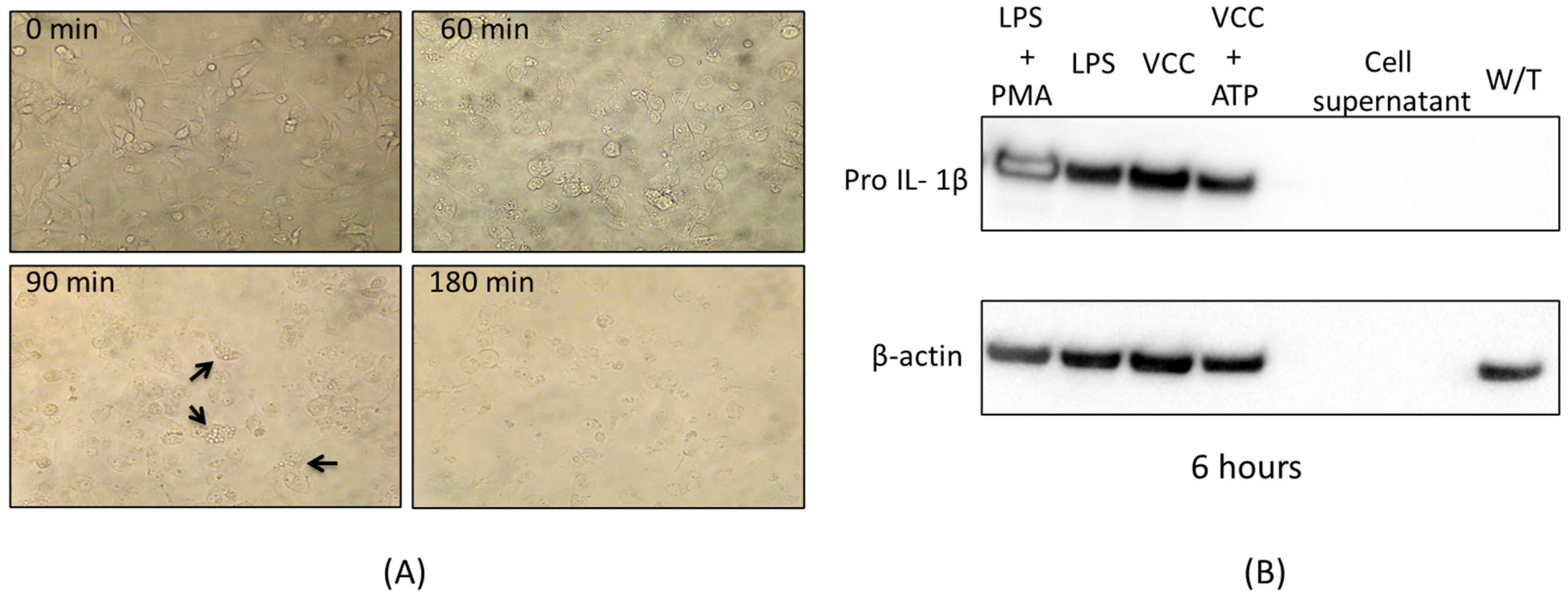 IJMS | Free Full-Text | Transcriptional Activation of a Pro