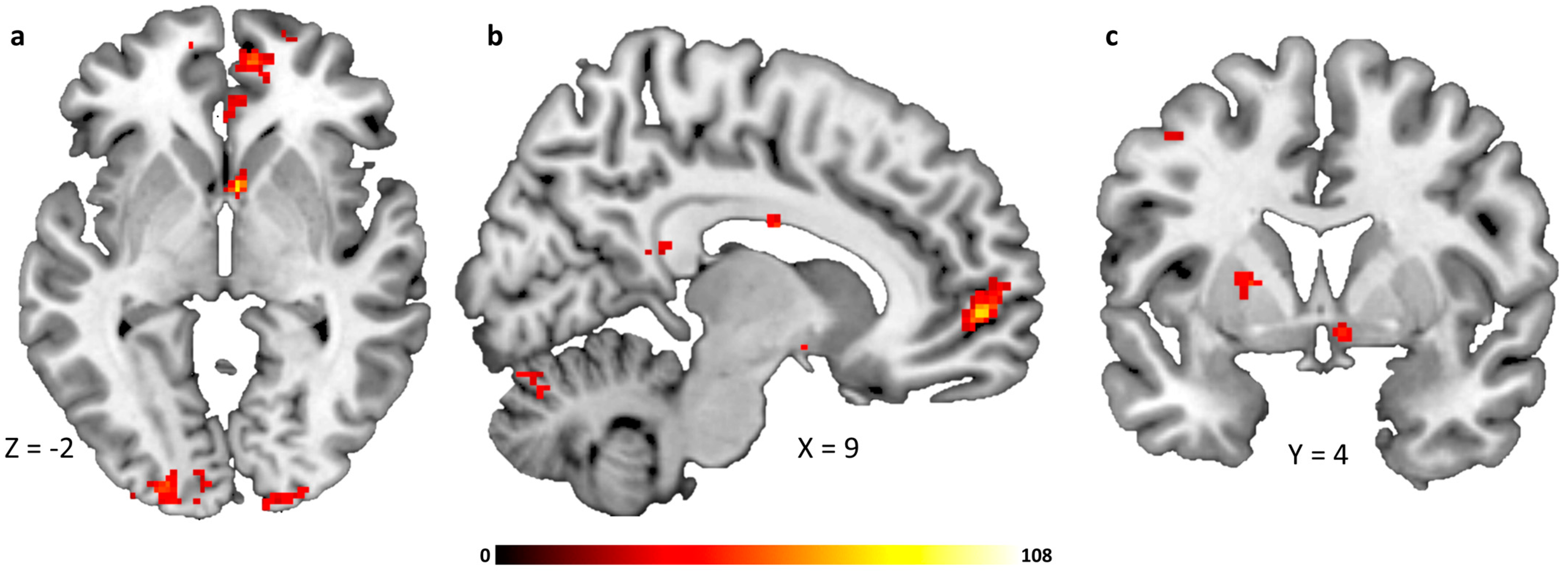 Ijms 24 07370 g004 Ijms 24 07370 g004