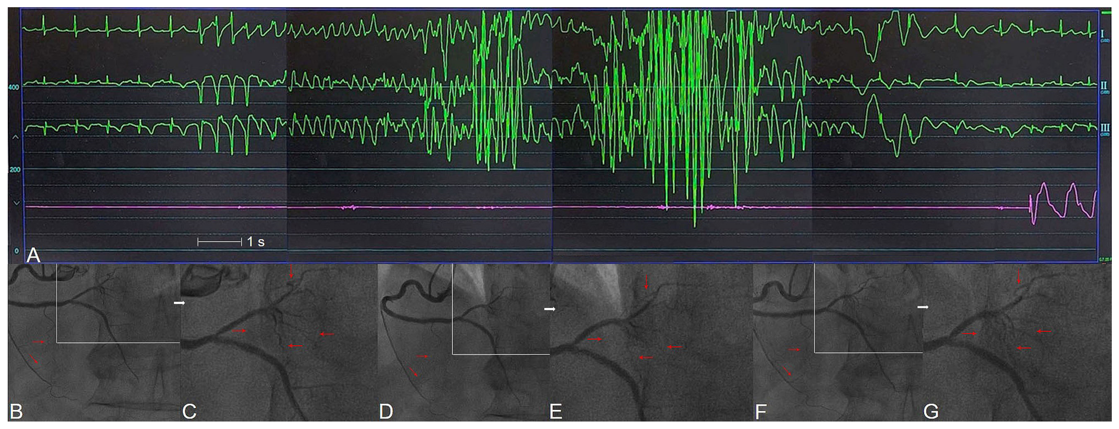 Ijms 24 07530 g004 Ijms 24 07530 g004