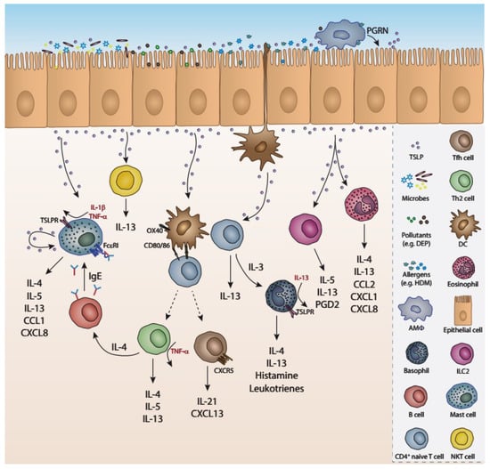 IJMS | Free Full-Text | Severe Asthmatic Responses: The Impact of TSLP