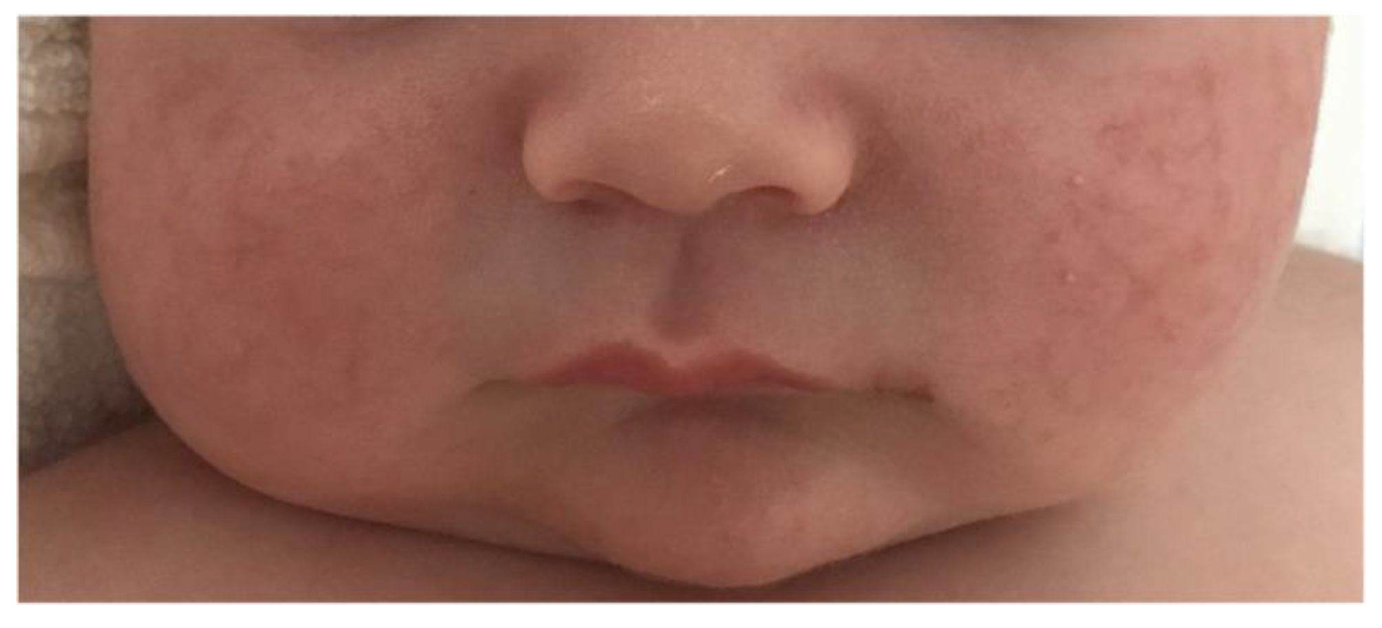 Ijms 24 07775 g004 Ijms 24 07775 g004