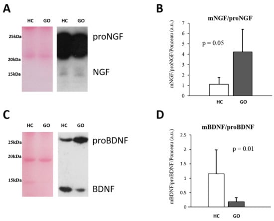 IJMS | Free Full-Text | Psycho-Cognitive Profile And NGF And BDNF ...