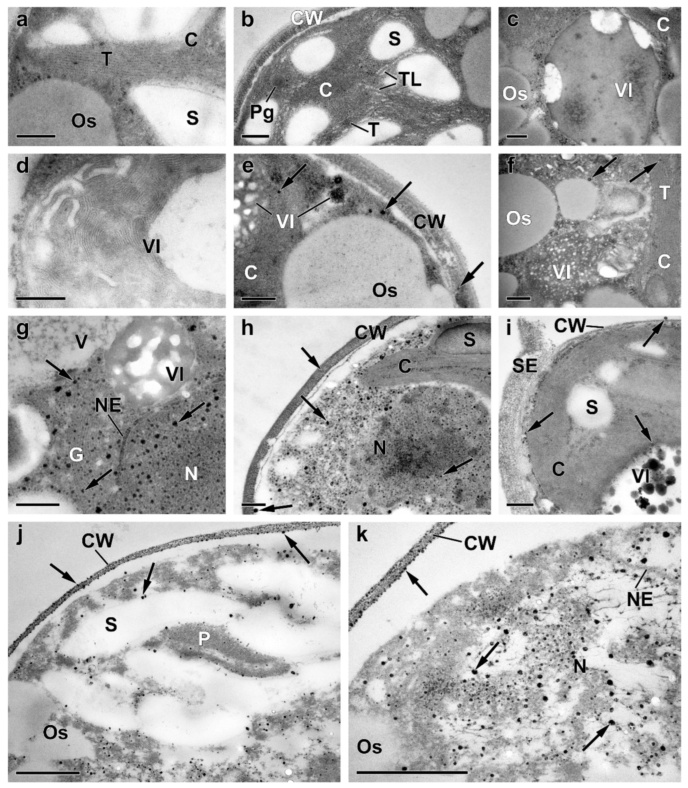 Ijms 24 08484 g0a1 Ijms 24 08484 g0a1