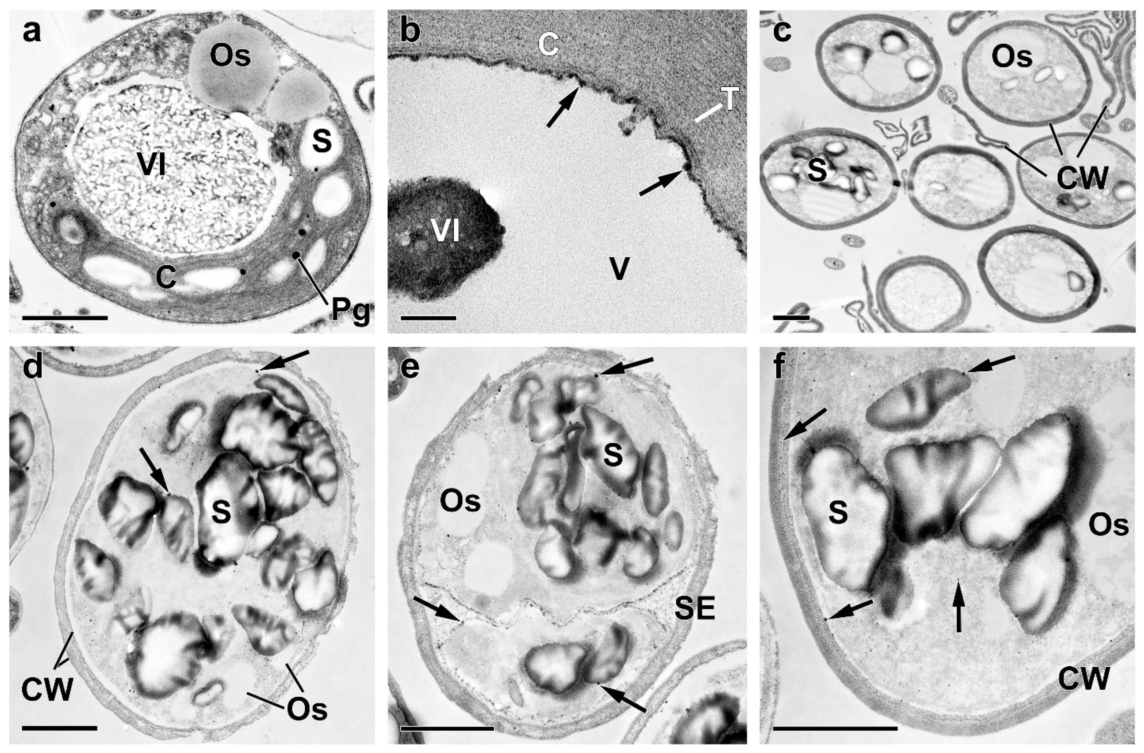 Ijms 24 08484 g0a2 Ijms 24 08484 g0a2