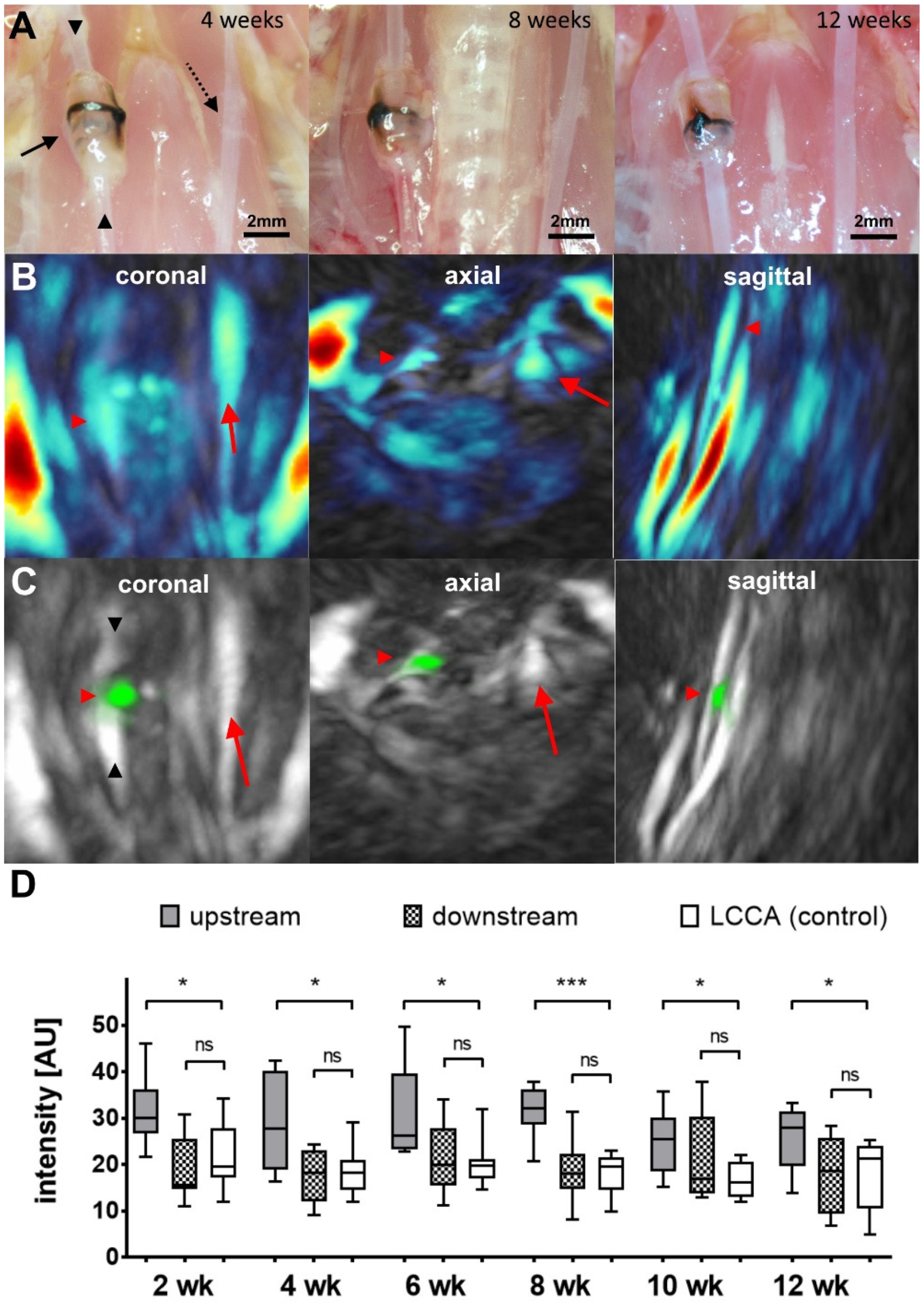 IJMS | Free Full-Text | Detection of Early Endothelial Dysfunction