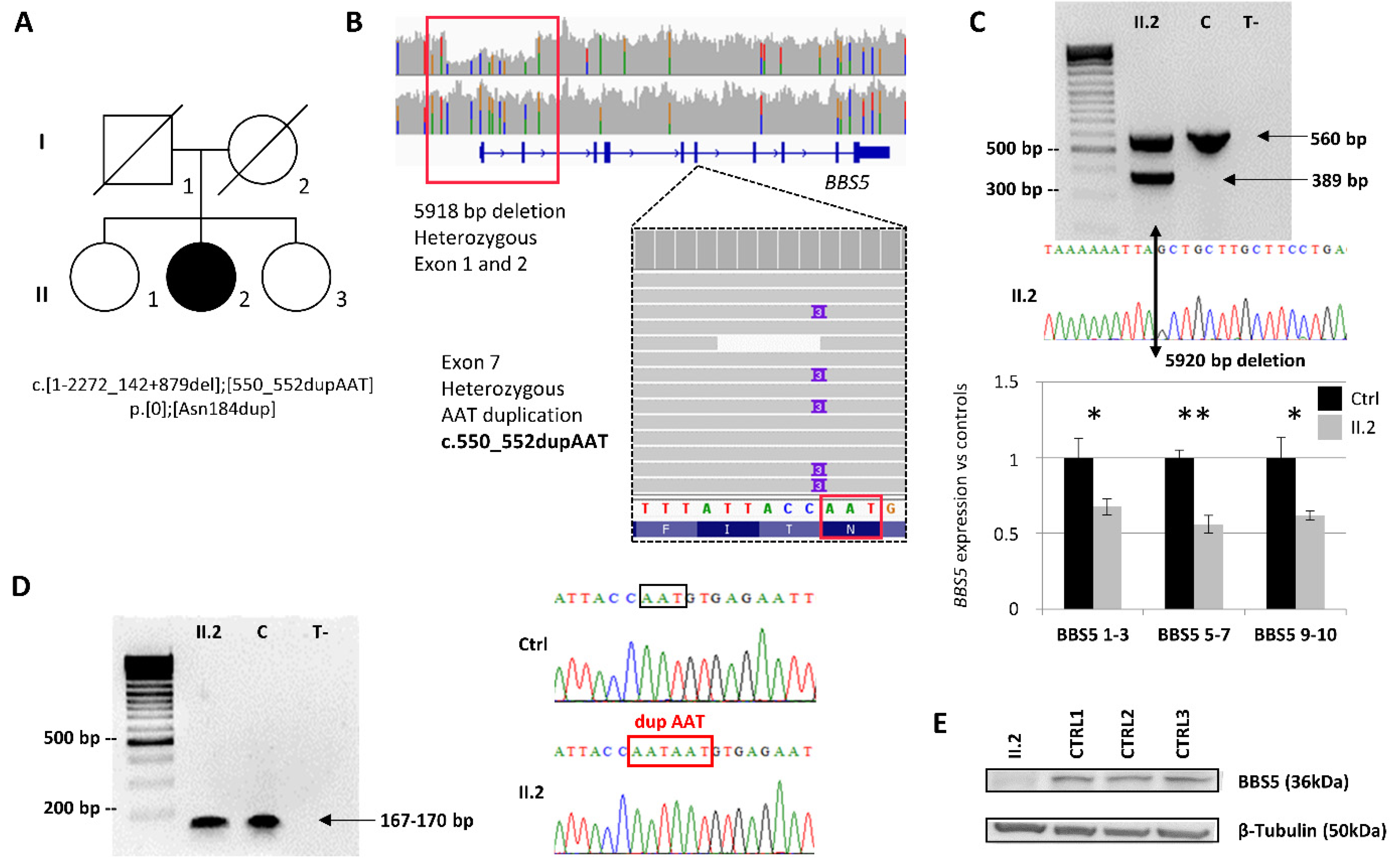 IJMS | Free Full-Text | WGS Revealed Novel BBS5 Pathogenic