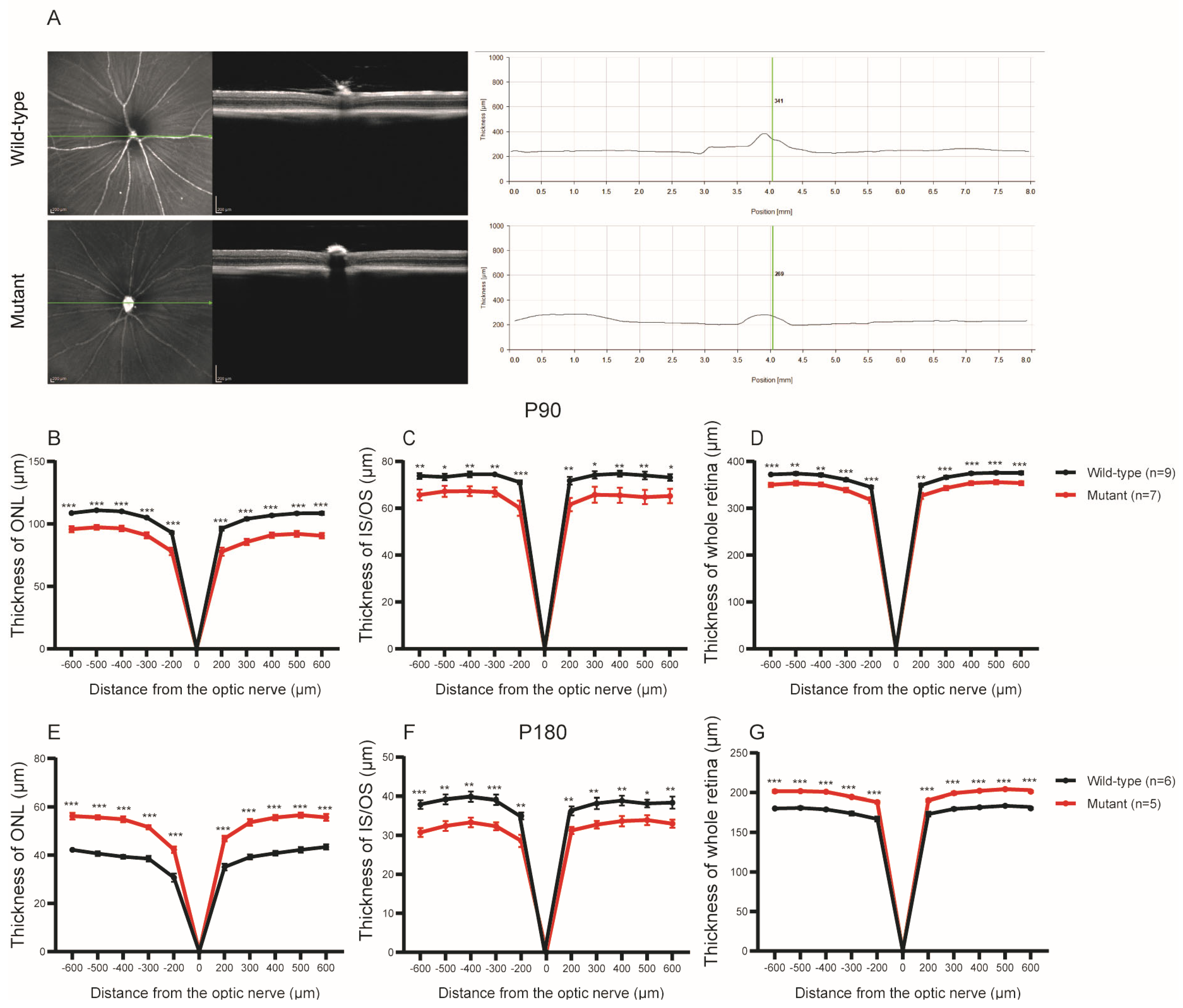 IJMS | Free Full-Text | RNA-Seq Analysis Reveals an Essential Role