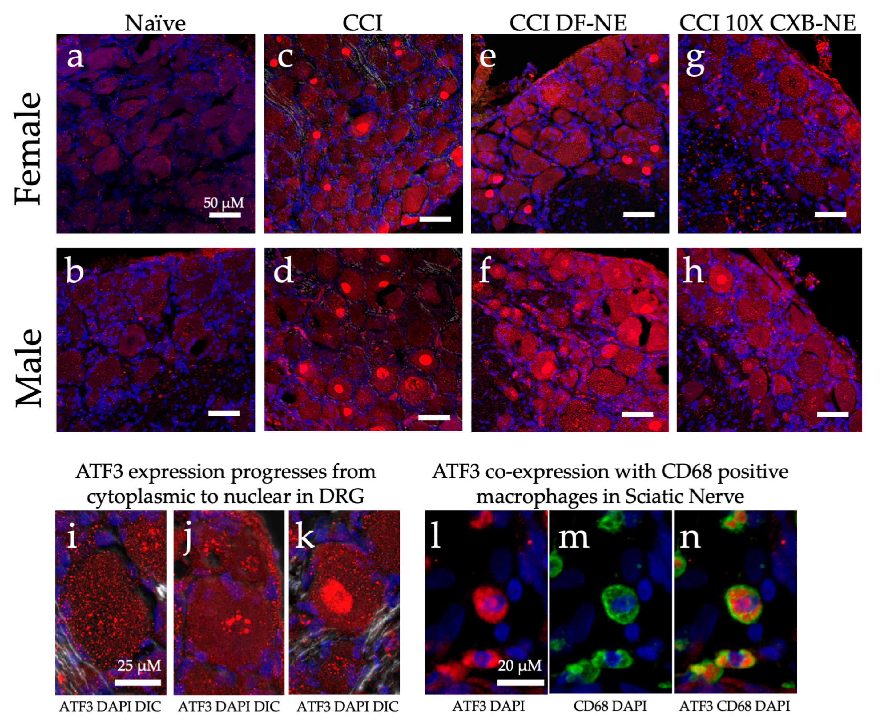 IJMS | Free Full-Text | RNA-Seq Reveals Sex Differences in Gene Expression  during Peripheral Neuropathic Inflammation and in Pain Relief from a COX-2  Inhibiting Theranostic Nanoemulsion