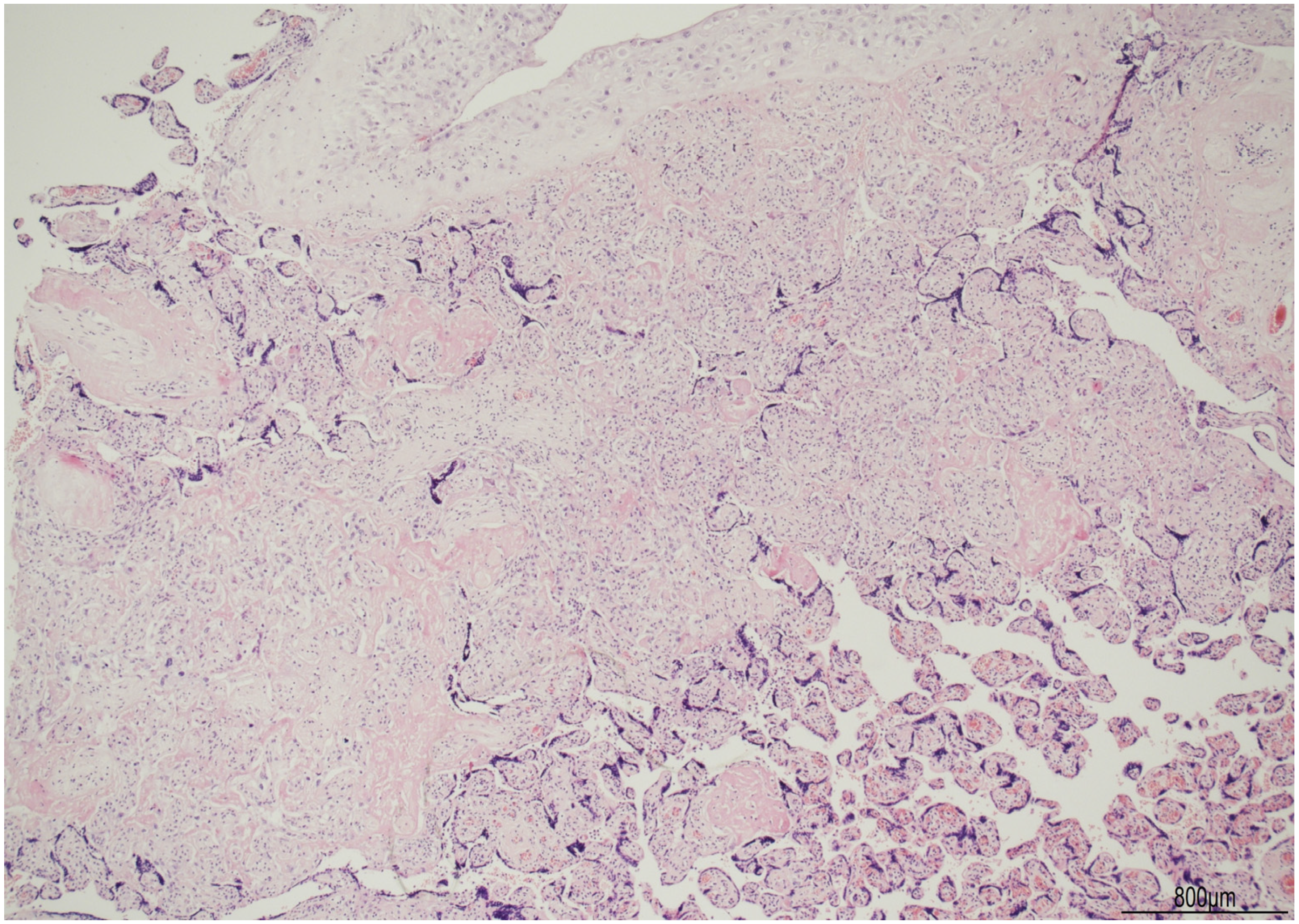 Ijms 24 09207 g005 Ijms 24 09207 g005