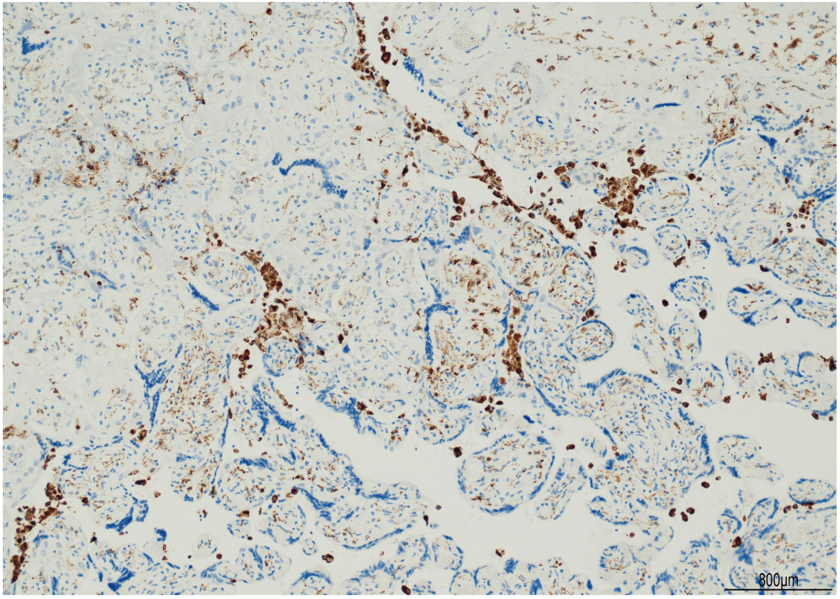 Ijms 24 09207 g006 Ijms 24 09207 g006