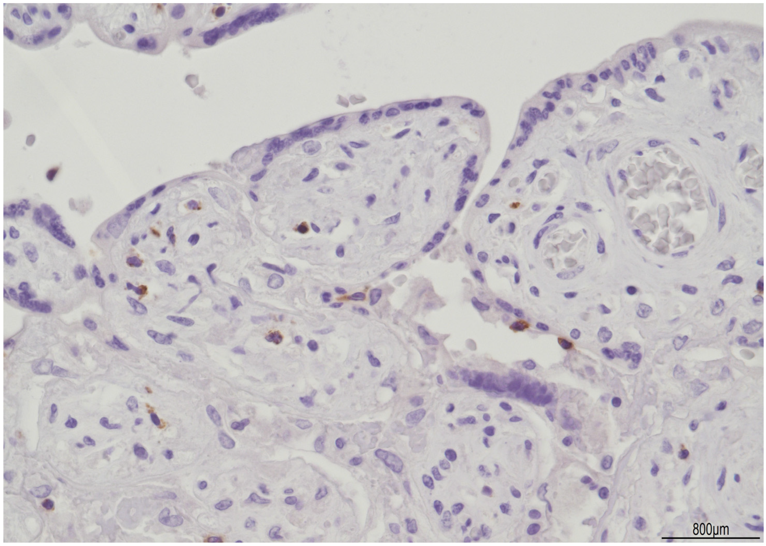 Ijms 24 09207 g008 Ijms 24 09207 g008