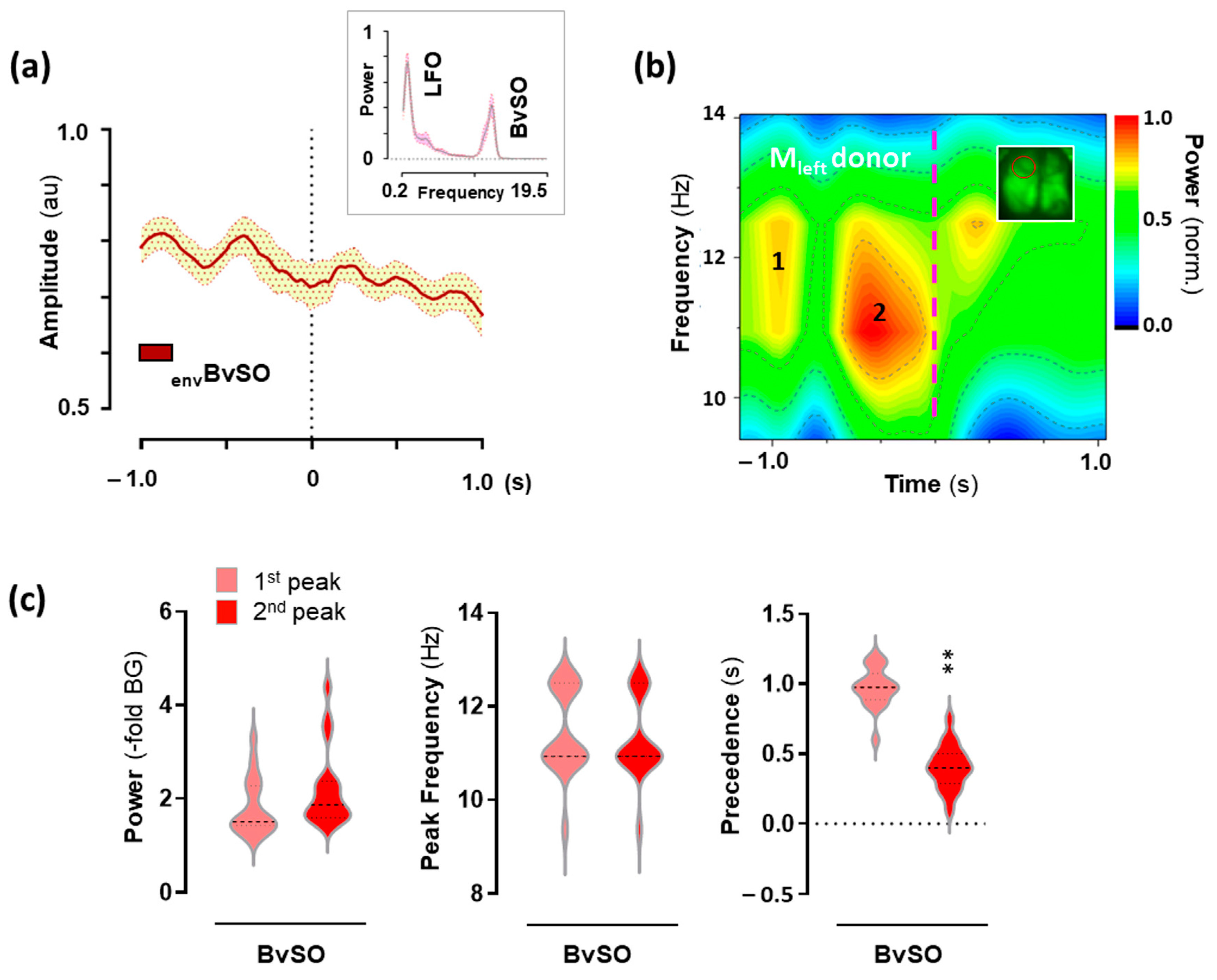 Ijms 24 09463 g004 Ijms 24 09463 g004