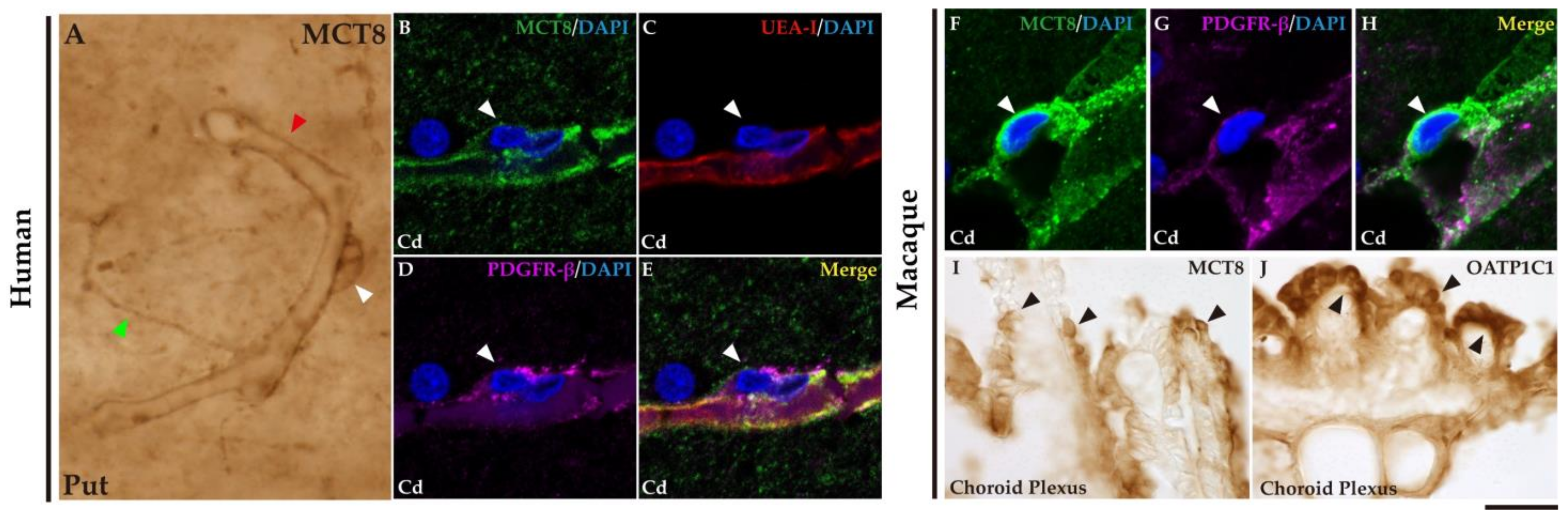 Ijms 24 09643 g004 Ijms 24 09643 g004