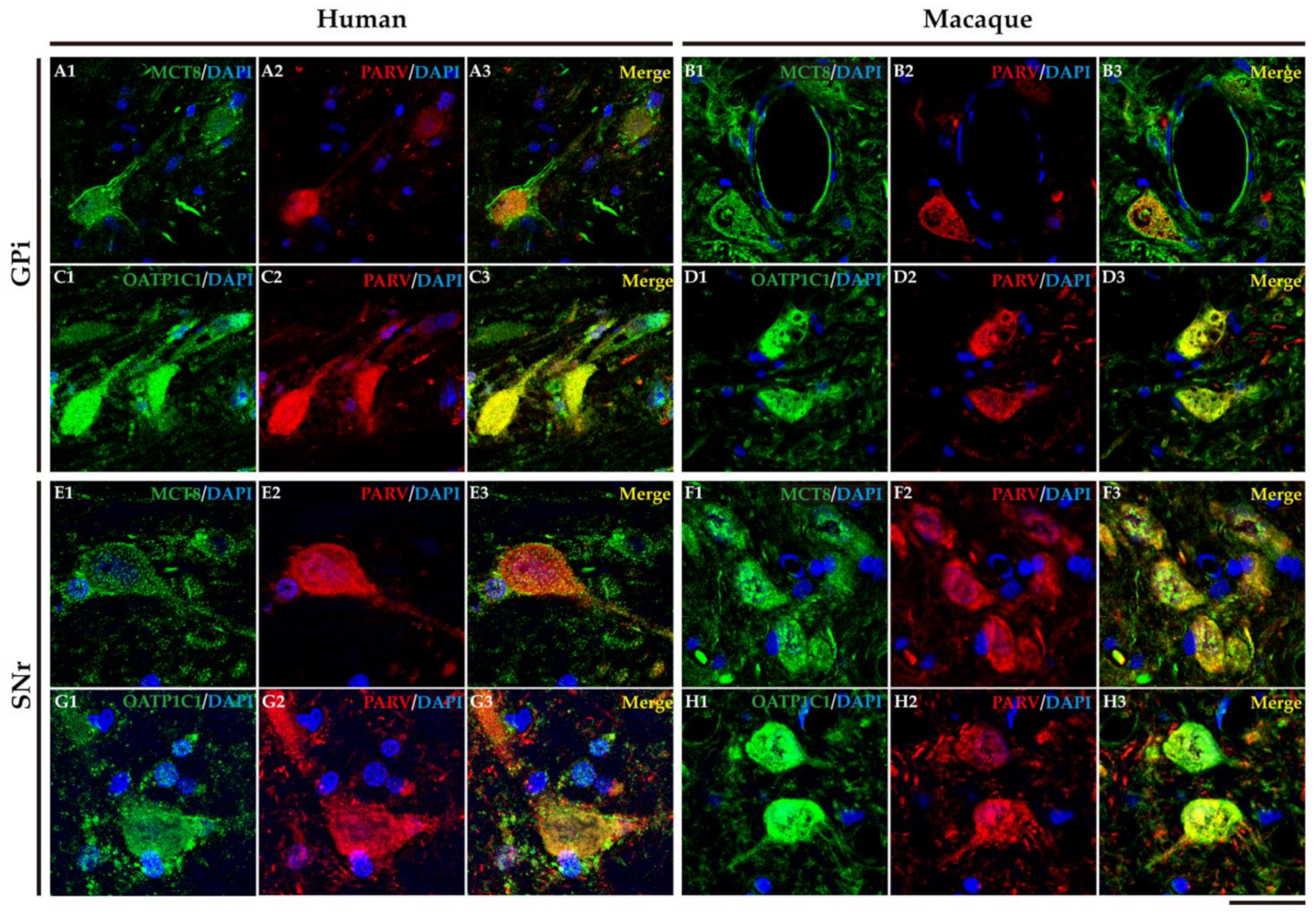 Ijms 24 09643 g011 Ijms 24 09643 g011