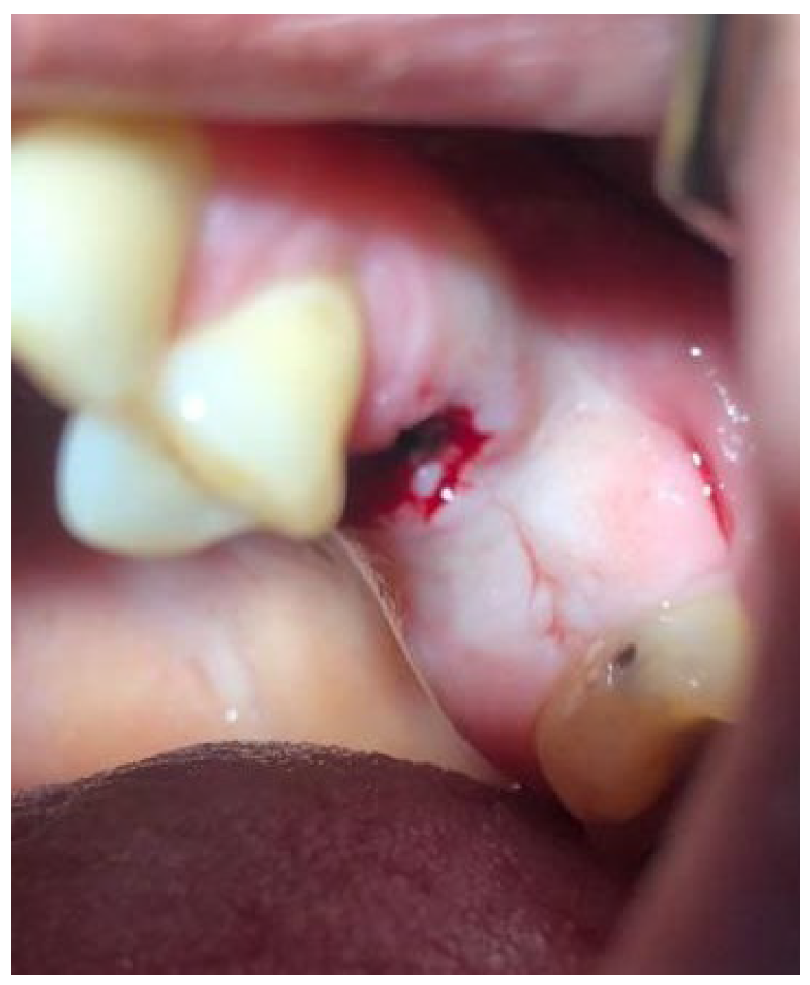 Ijms 24 09678 g017 Ijms 24 09678 g017