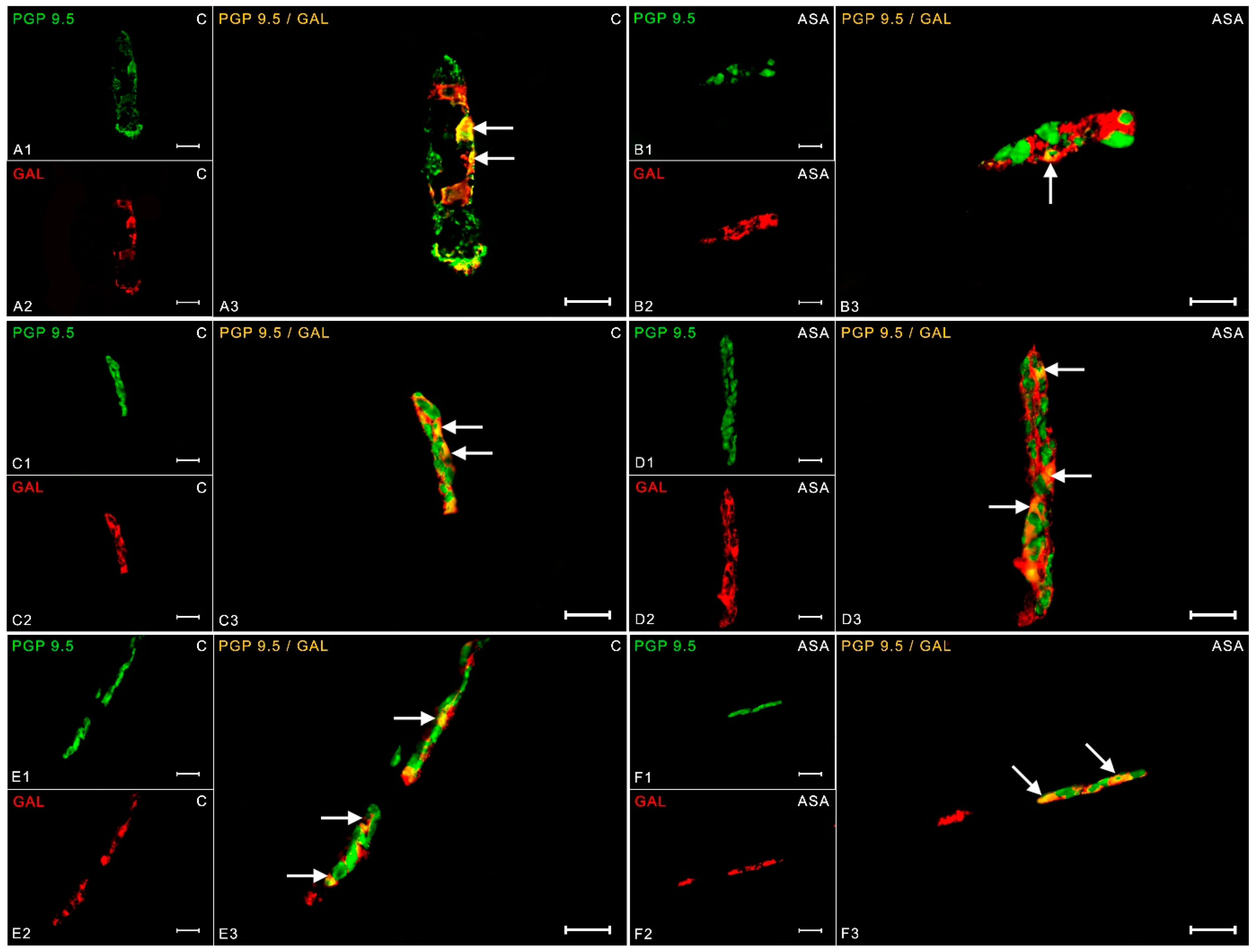 Ijms 24 09871 g005 Ijms 24 09871 g005