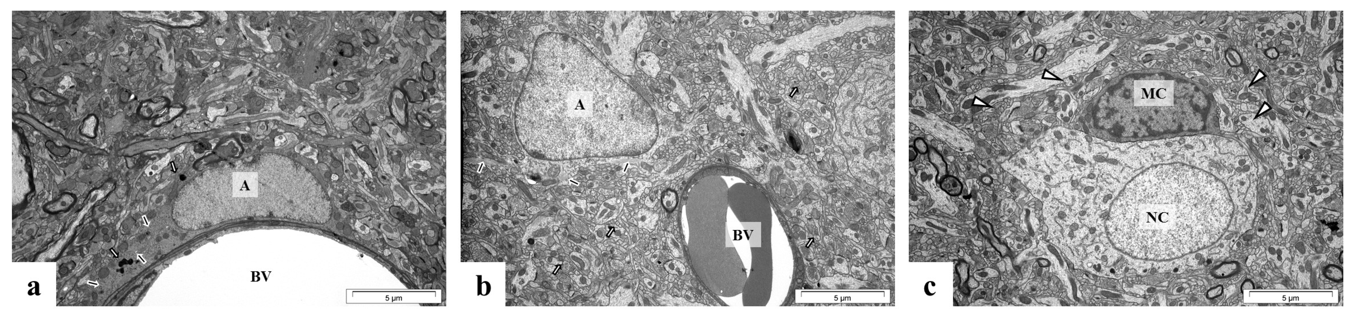 Ijms 24 09903 g009 Ijms 24 09903 g009