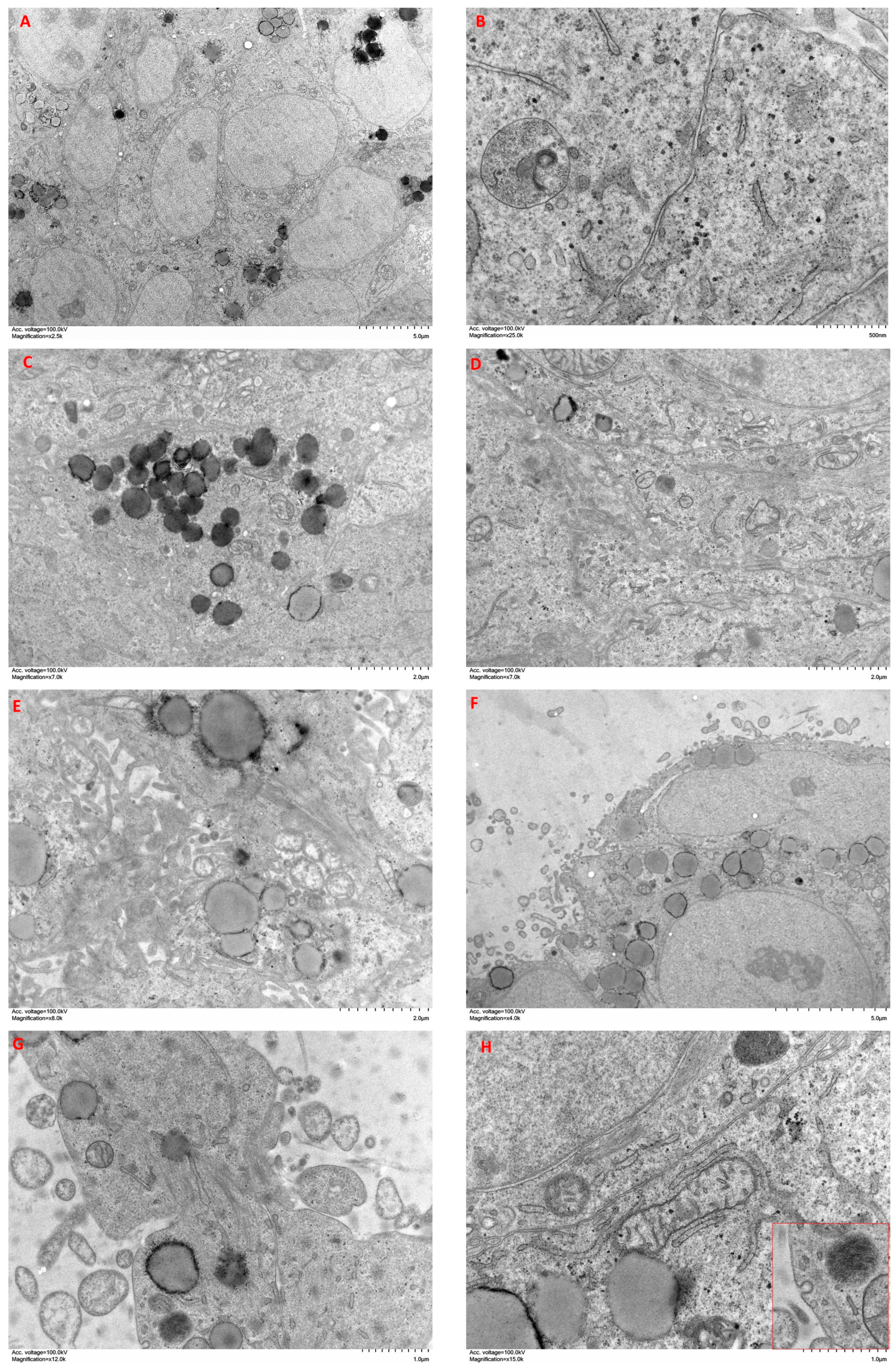 Ijms 24 10131 g007 Ijms 24 10131 g007