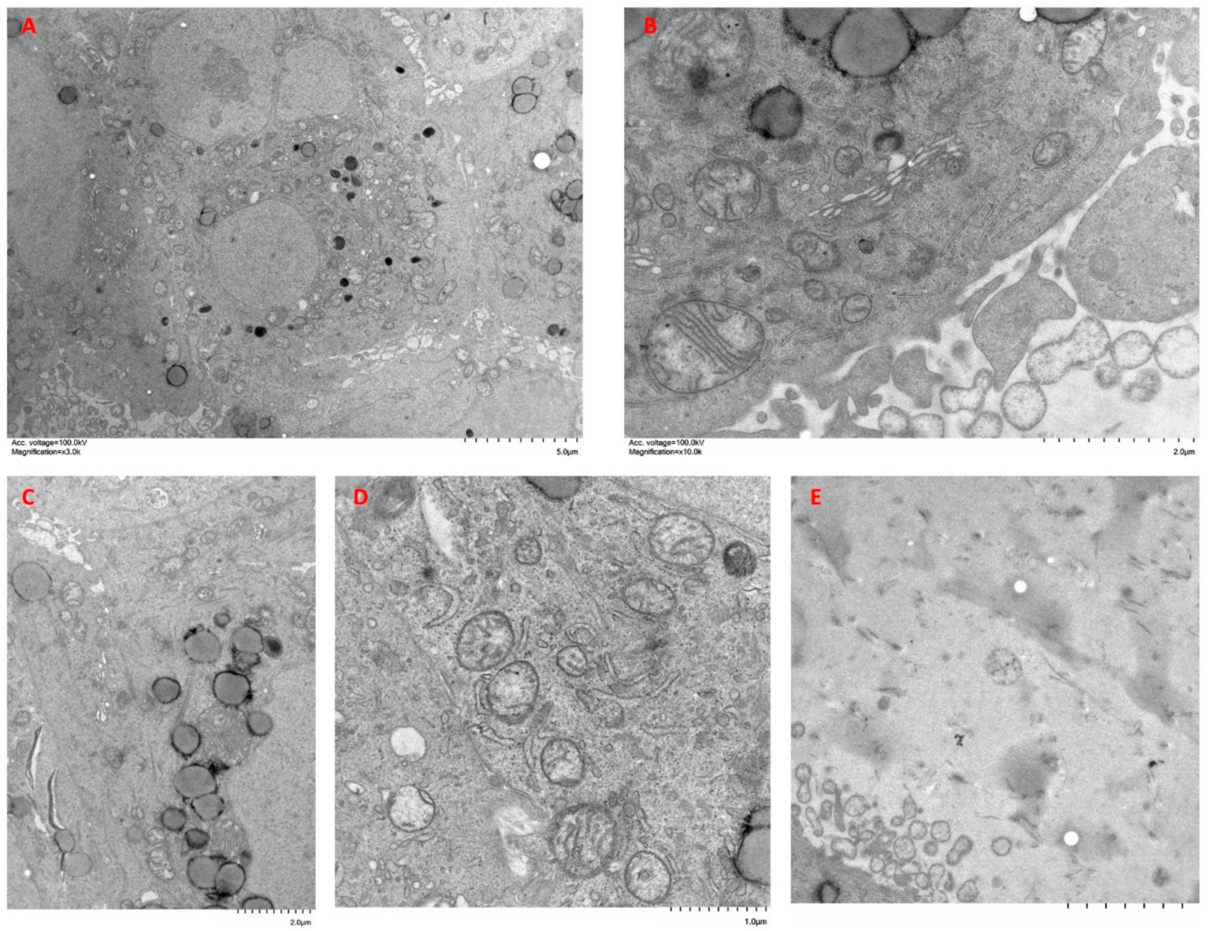 Ijms 24 10131 g008 Ijms 24 10131 g008