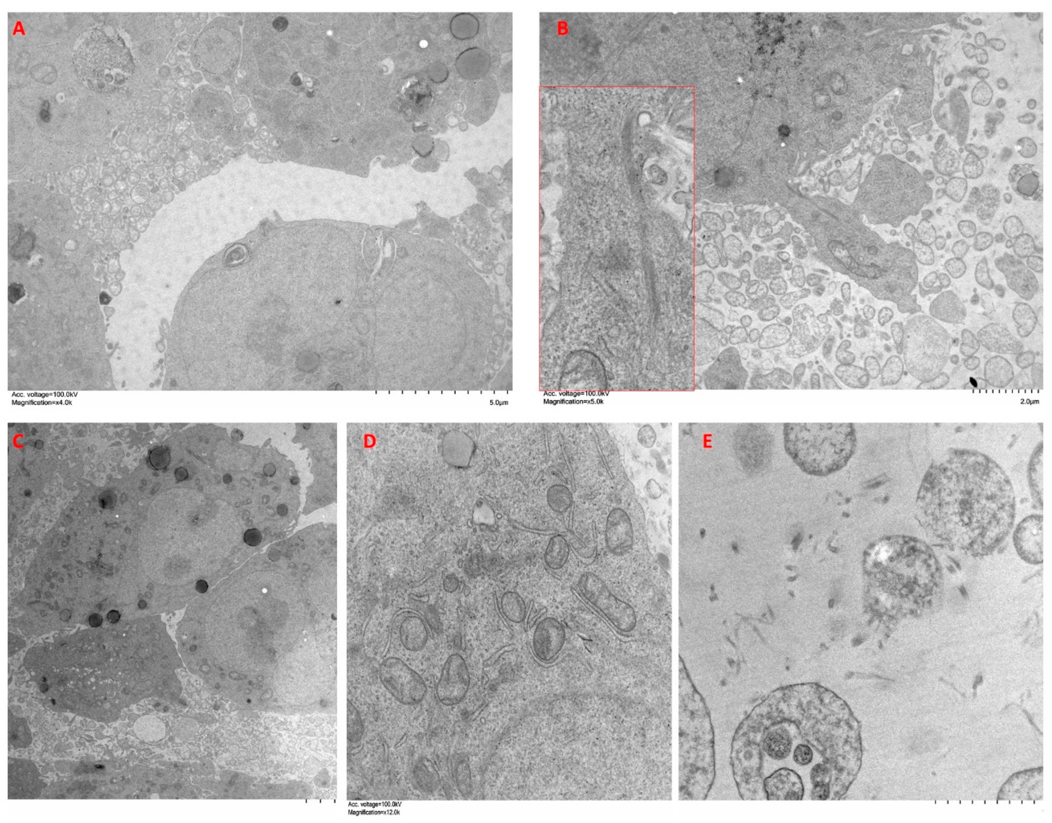 Ijms 24 10131 g009 Ijms 24 10131 g009