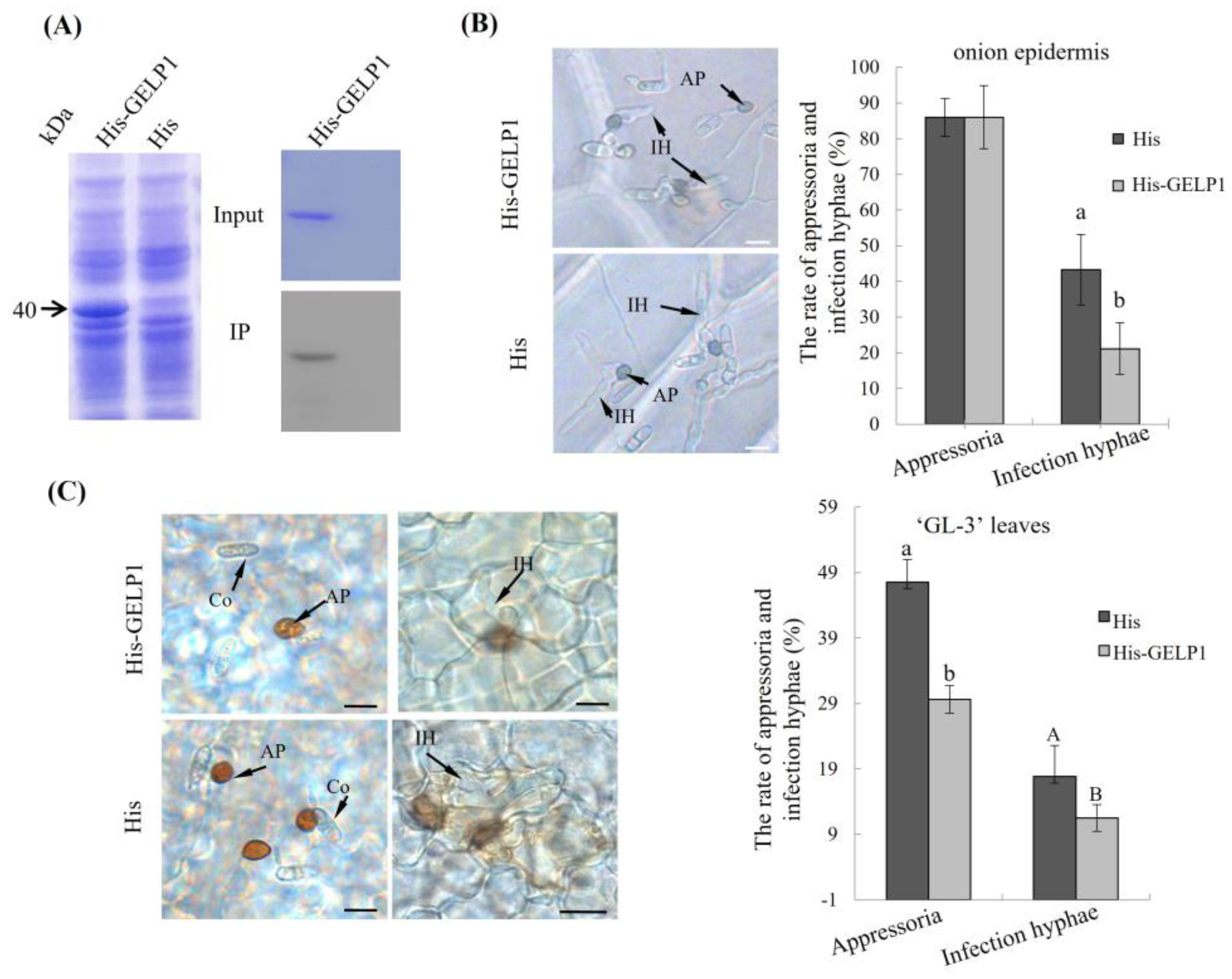 Ijms 24 10343 g004 Ijms 24 10343 g004