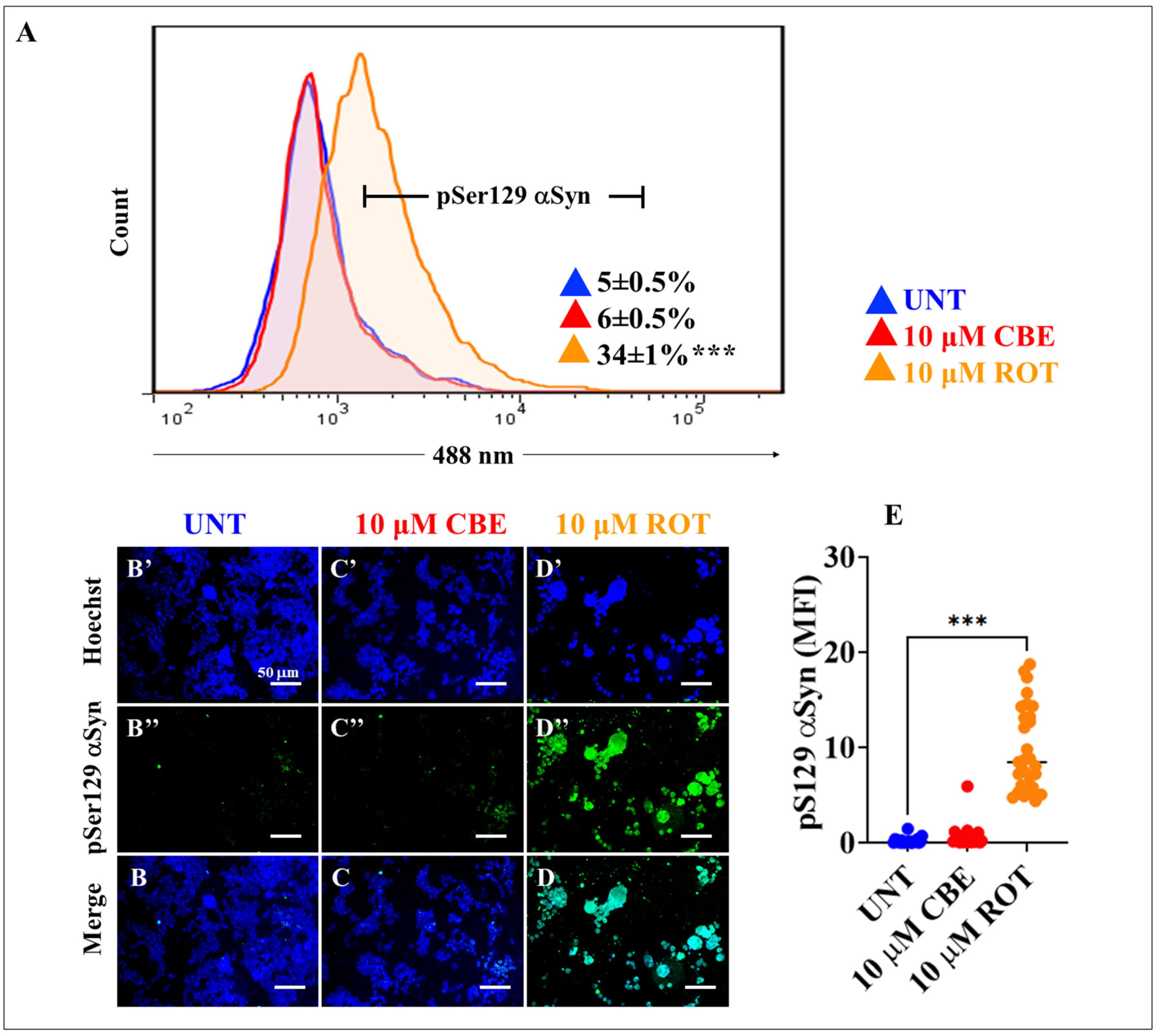 IJMS | Free Full-Text | Rotenone Blocks the Glucocerebrosidase 