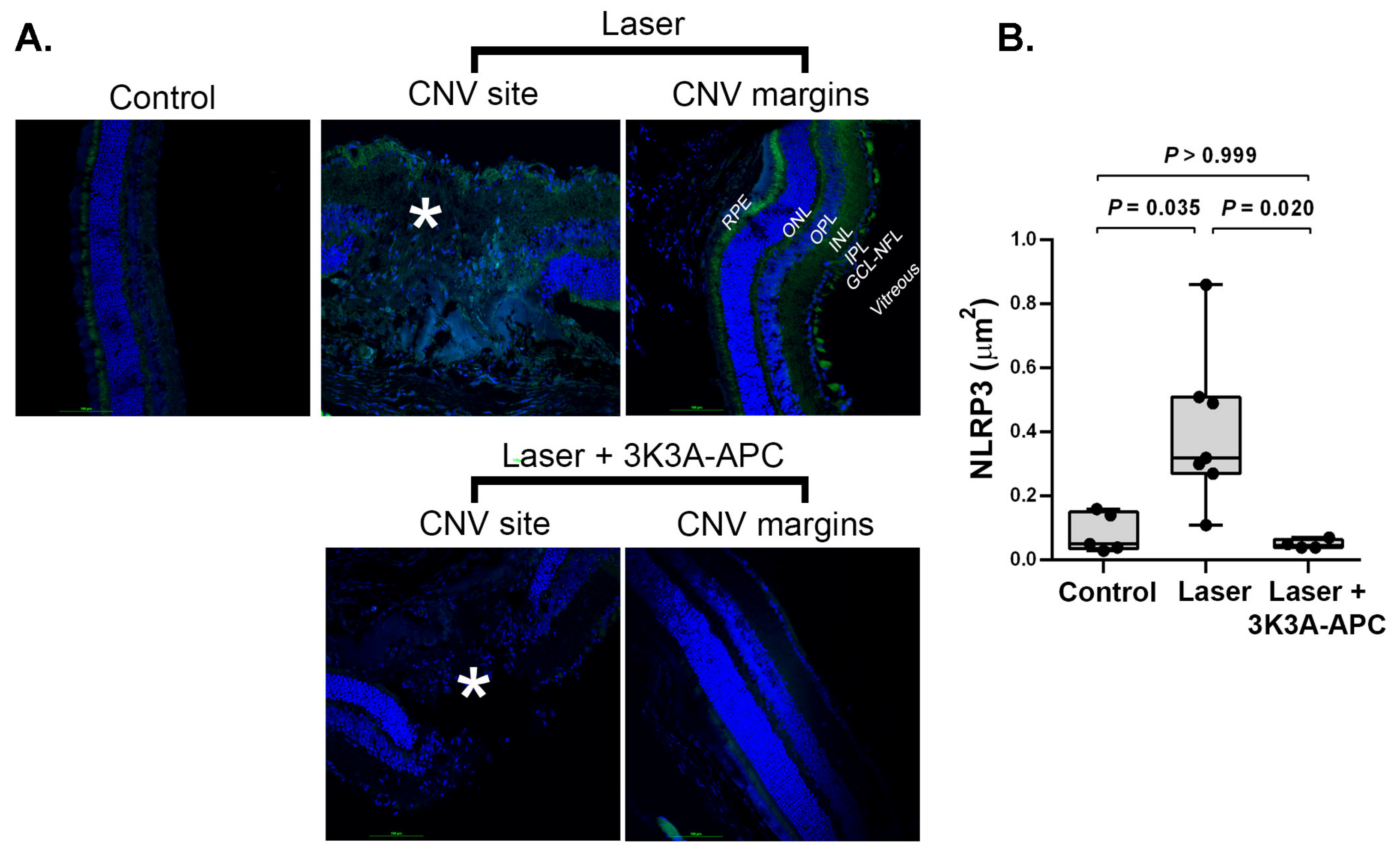 IJMS | Free Full-Text | 3K3A-Activated Protein C Inhibits